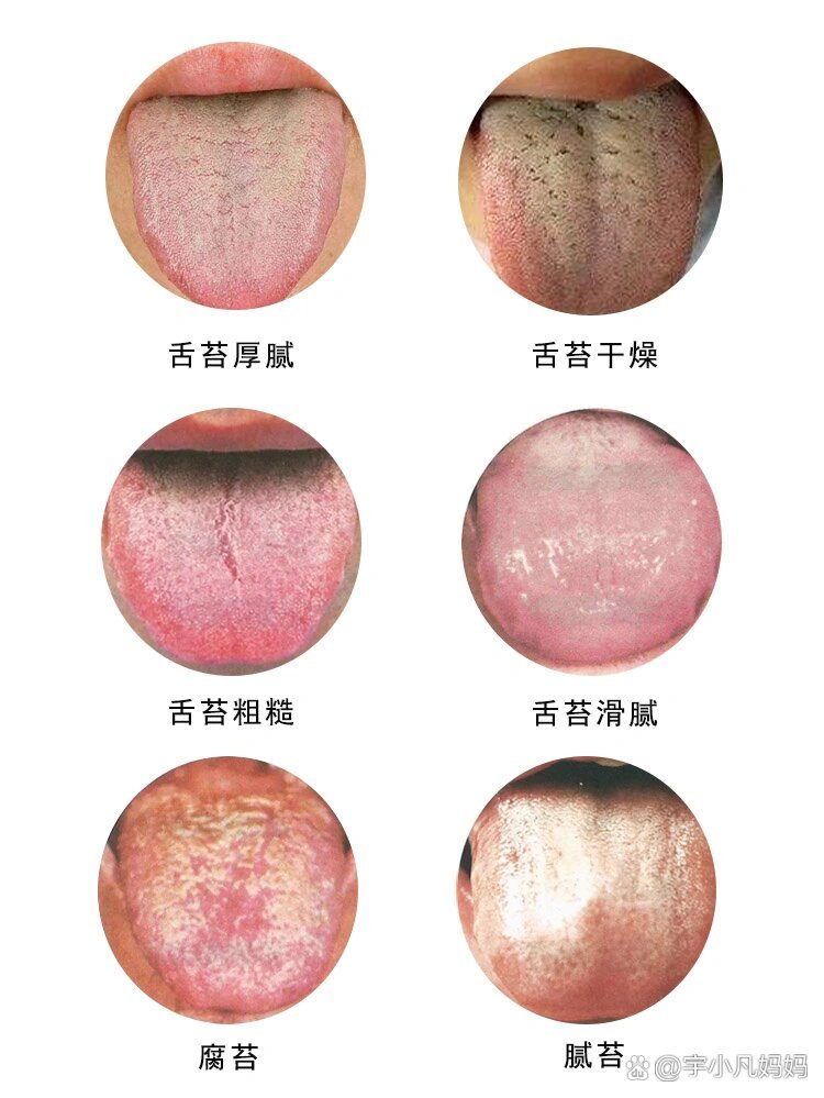 从舌苔看身体健康,你的舌苔长什么样子?