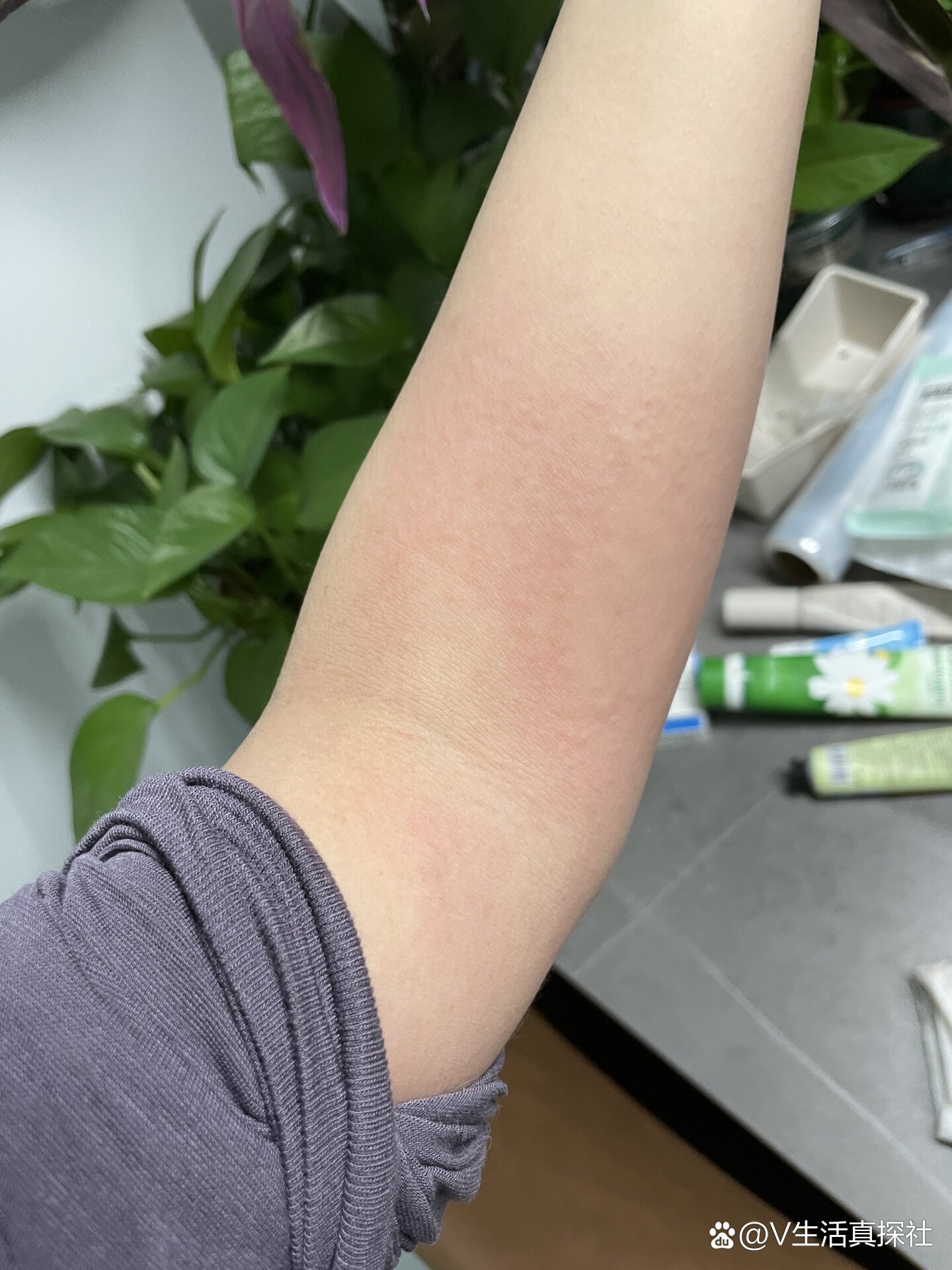  疫情后遗症有哪三大症状(疫情后遗症有多可怕)