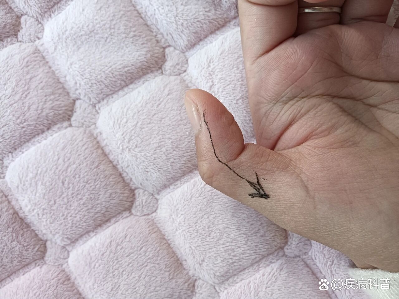  p>口水多,流口水这样做 br>口水多的收摄不住,中医讲是脾虚克制不住