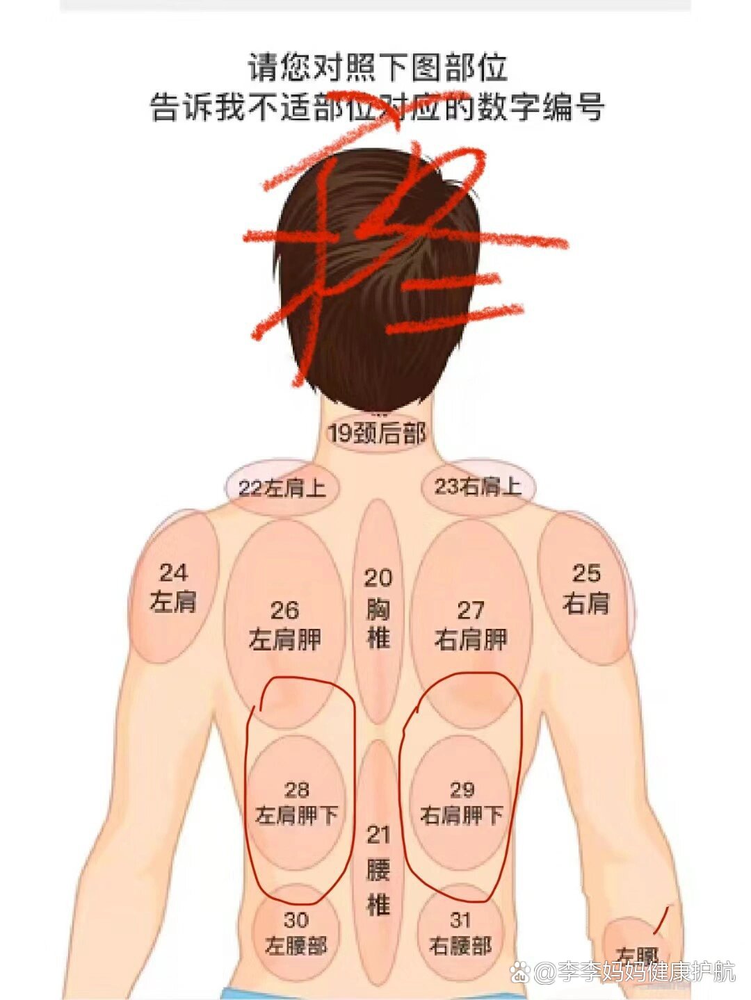 右后背疼痛