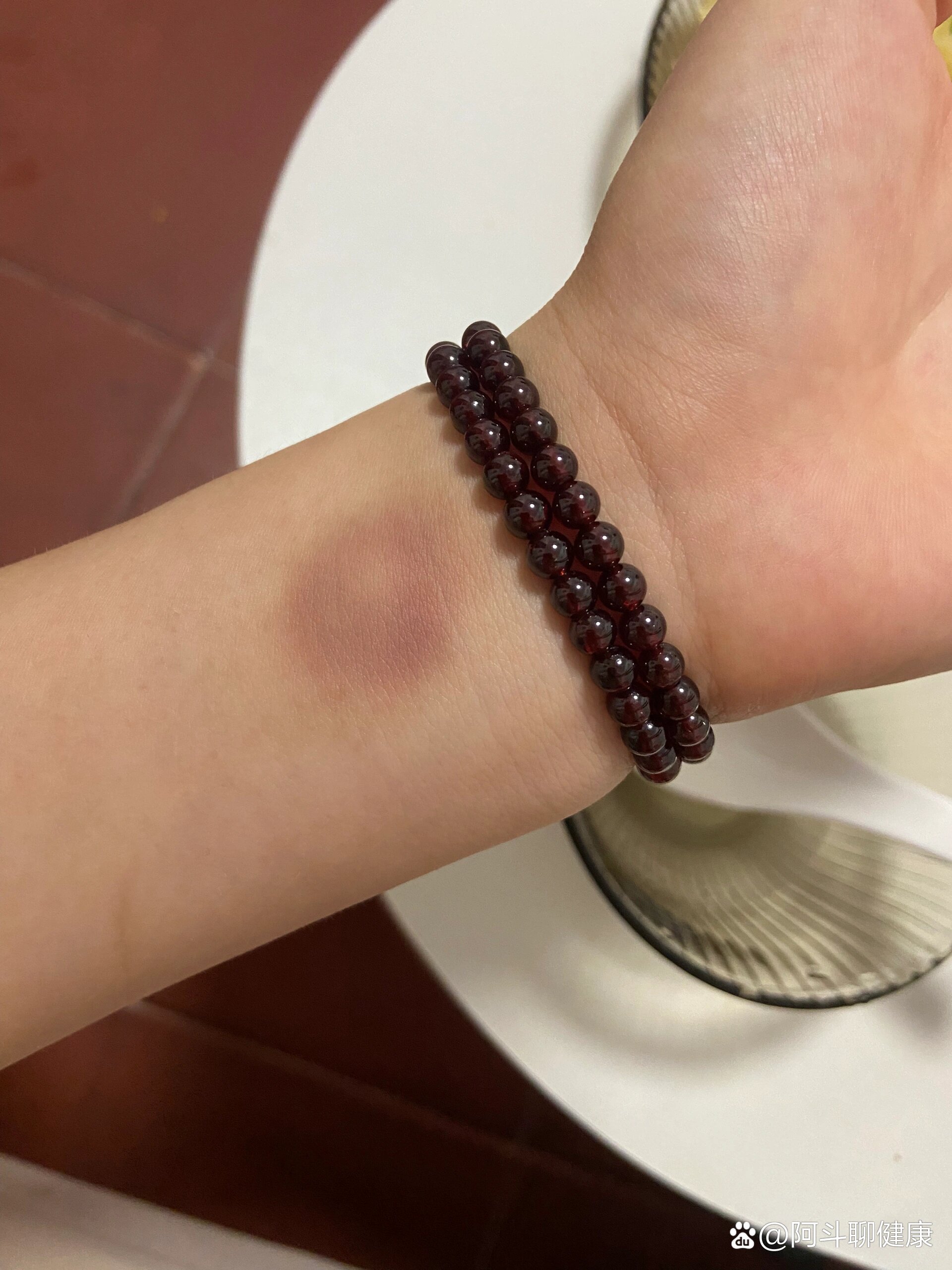 睡醒起床手腕莫名其妙青了一块