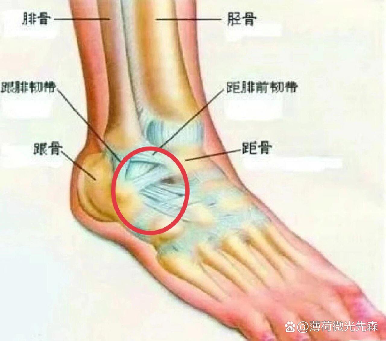 跟骨疼是怎么回事图片