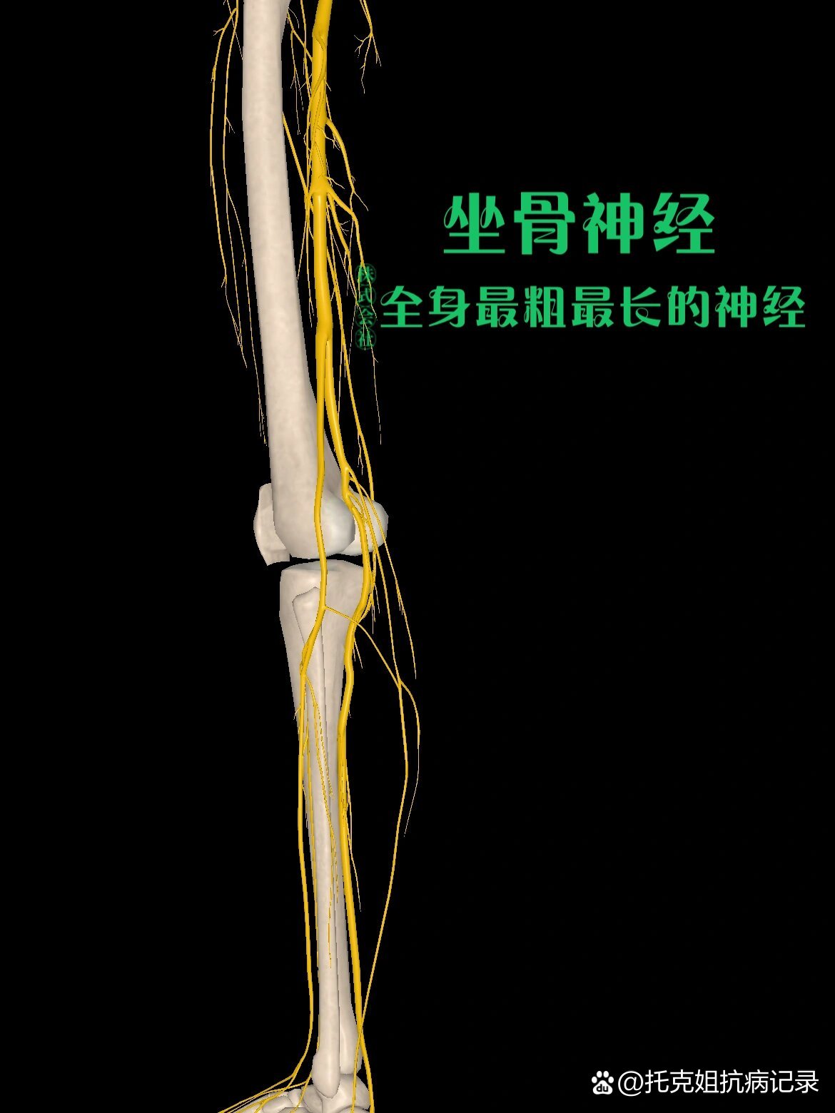 坐骨大孔内容物图片