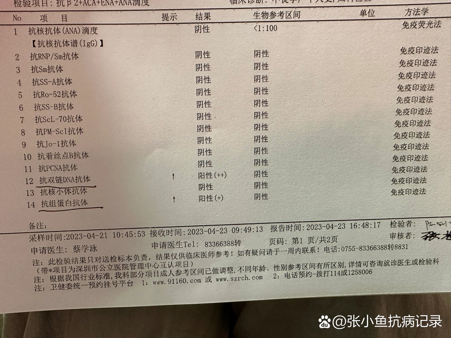 抗双链dna抗体,抗组蛋白抗体阳性