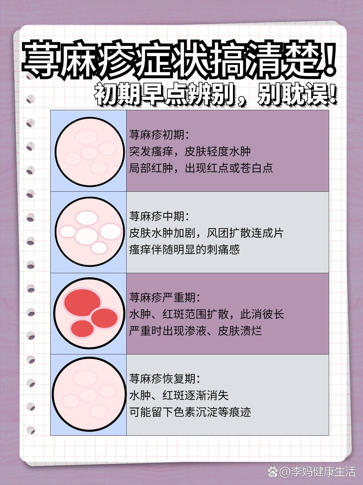 荨麻疹是什么引起的!