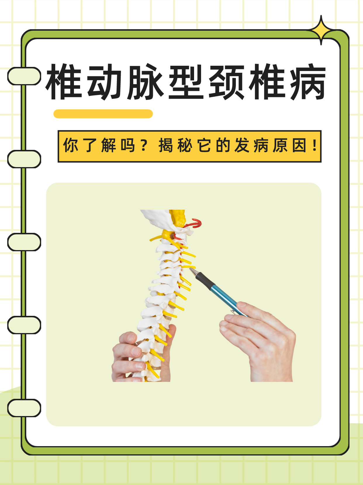 椎动脉型颈椎病,你了解吗?揭秘它的发病原因!