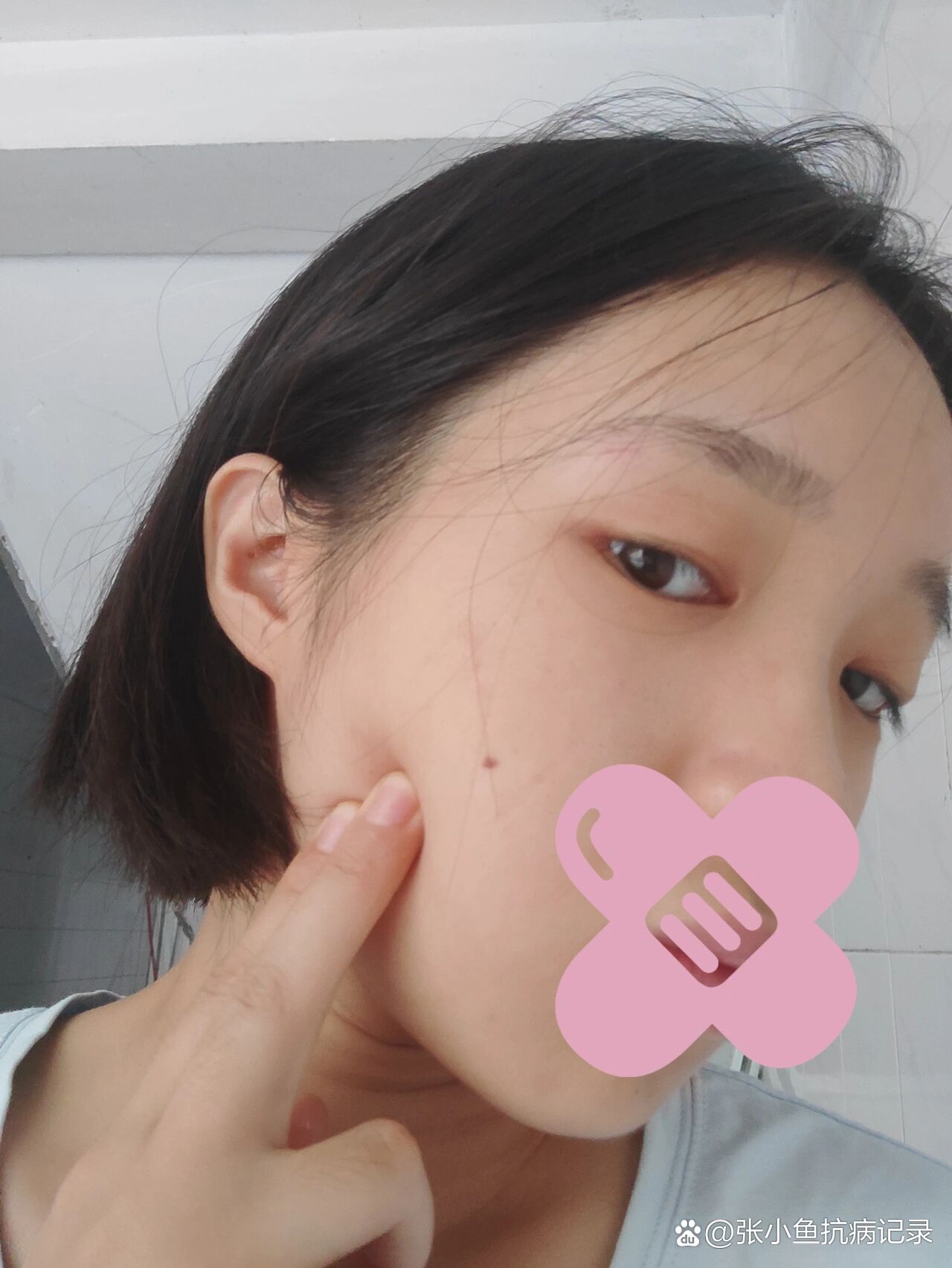 这里有一个疙瘩会动
