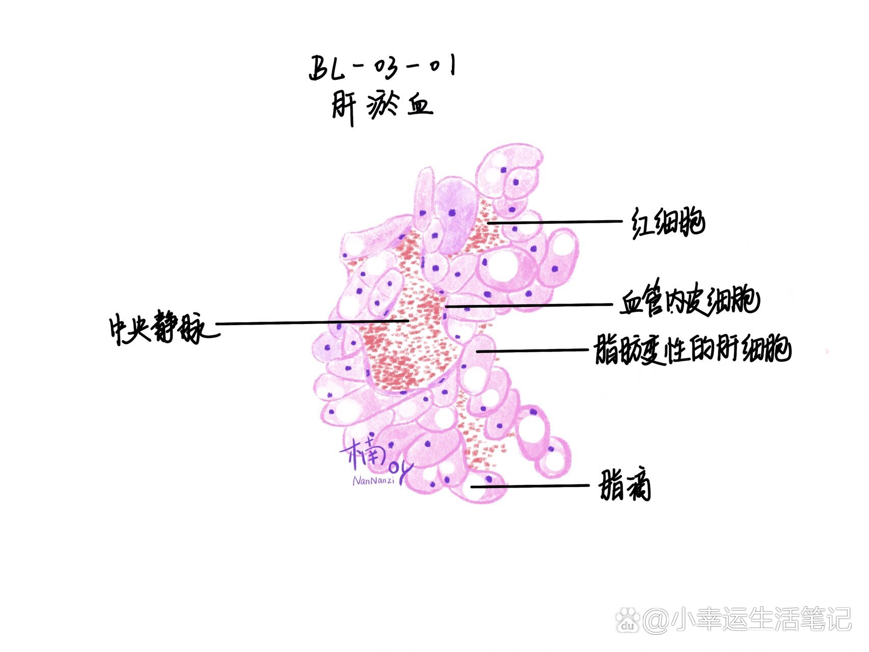 肝淤血大体手绘图图片