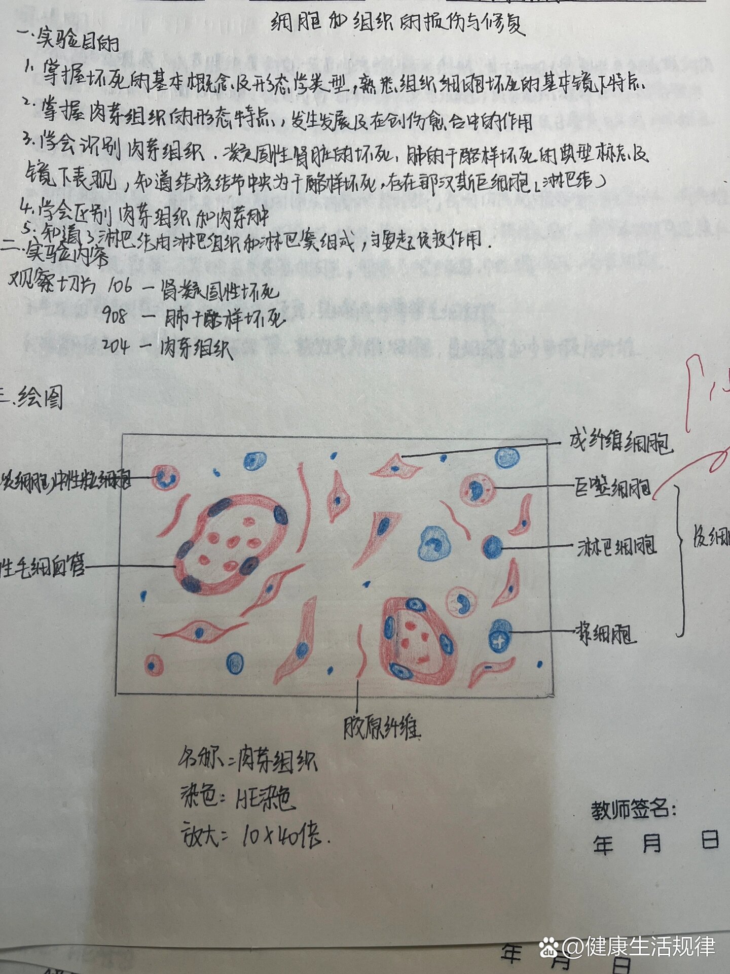 病理学肉芽组织图片