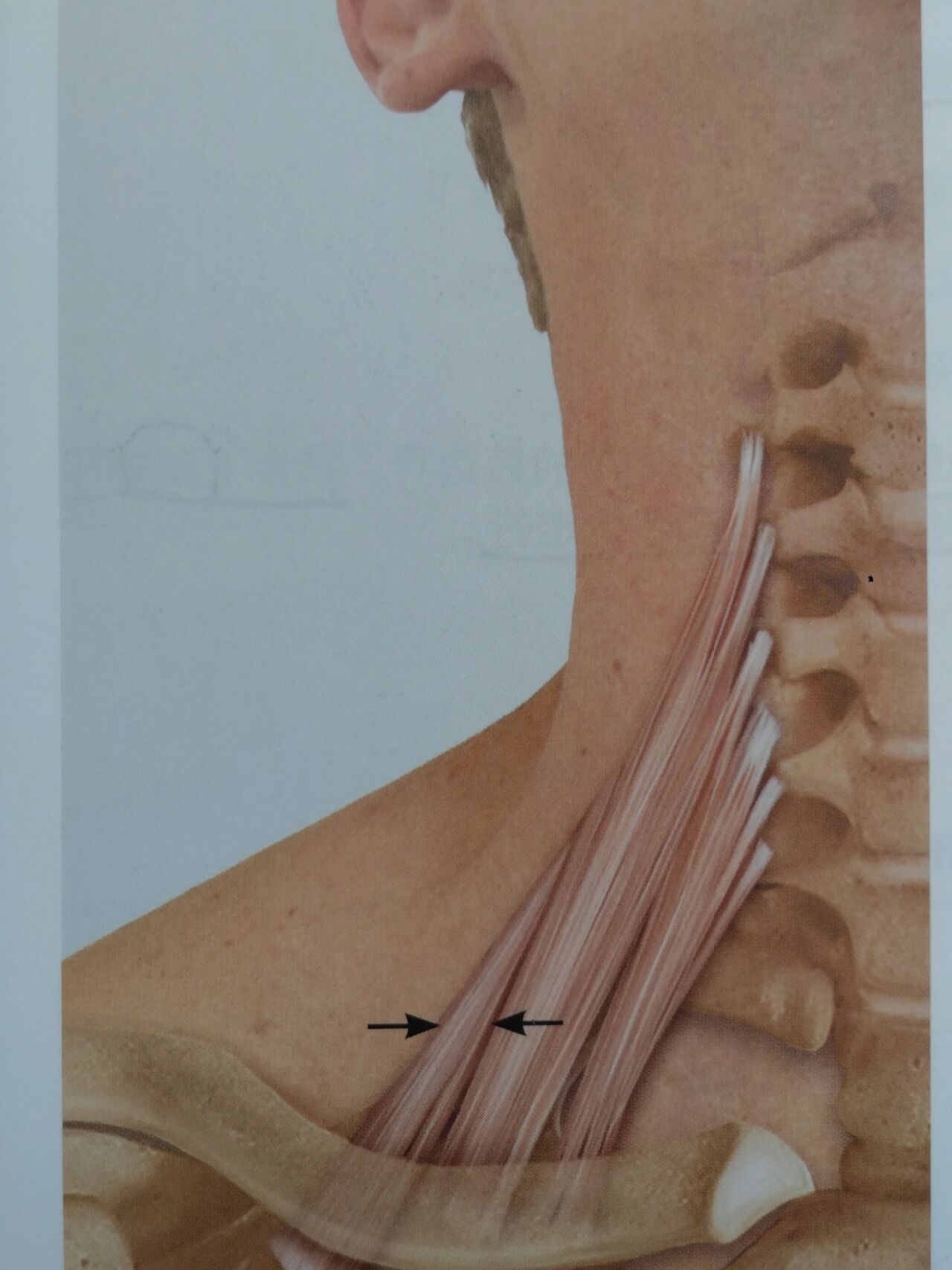 前斜角肌图片图片