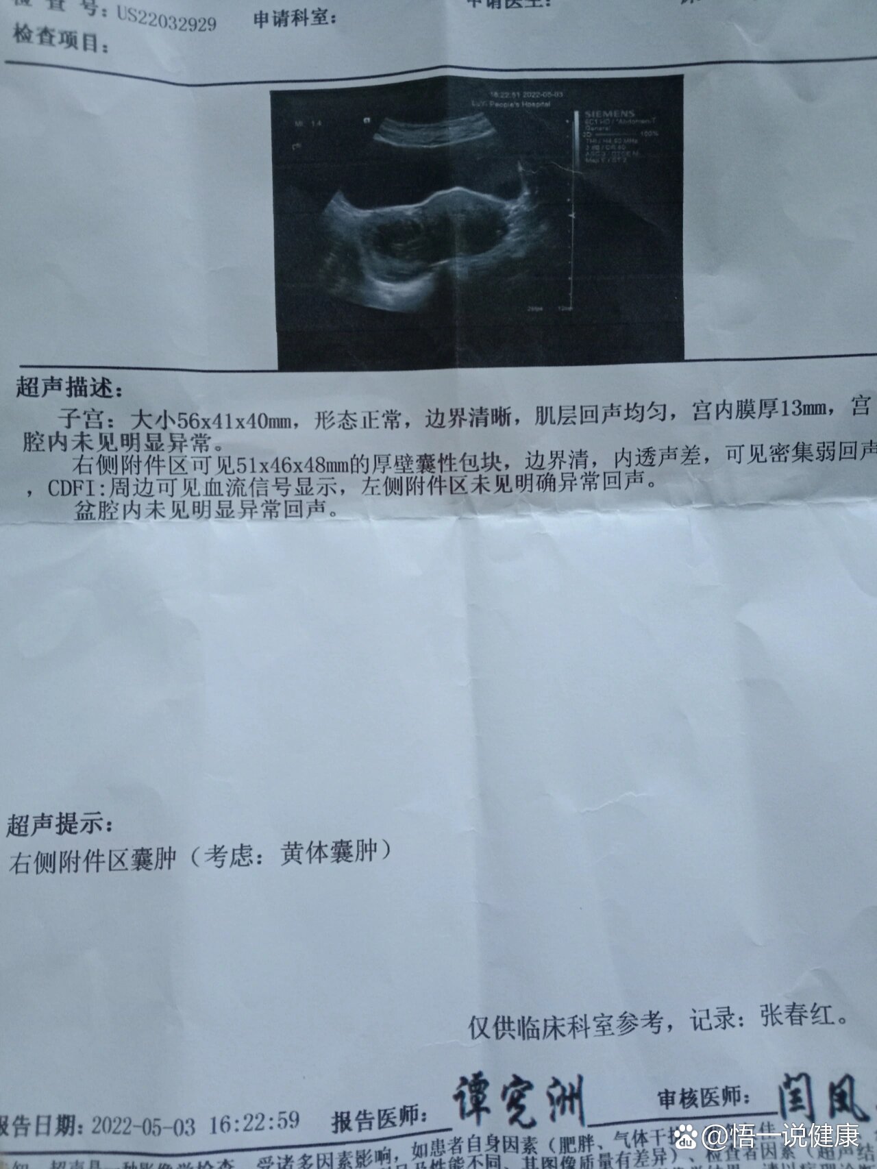 卵巢黄体囊肿好烦人,有和我情况一样的吗