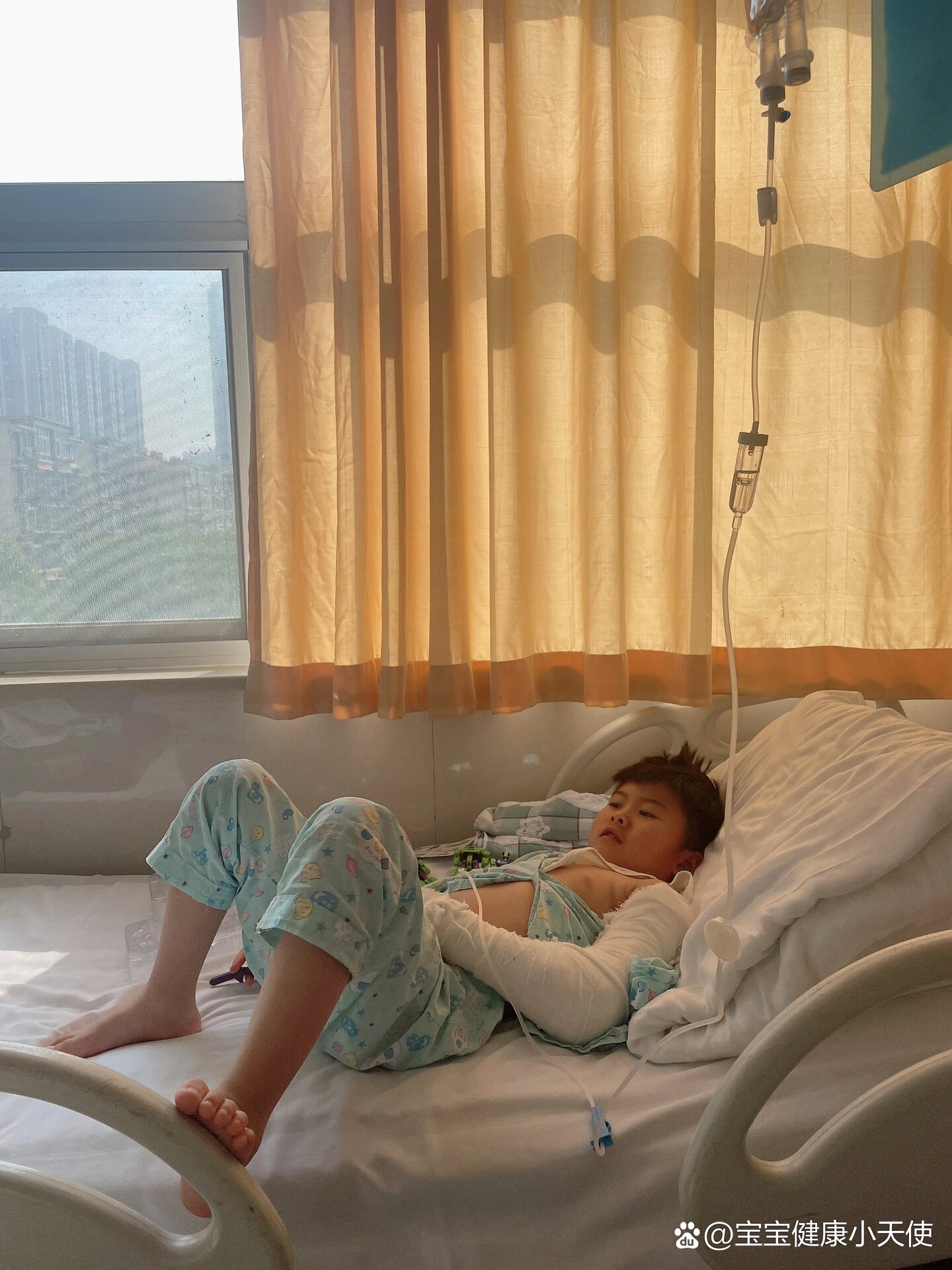 7岁左臂肱骨骨折