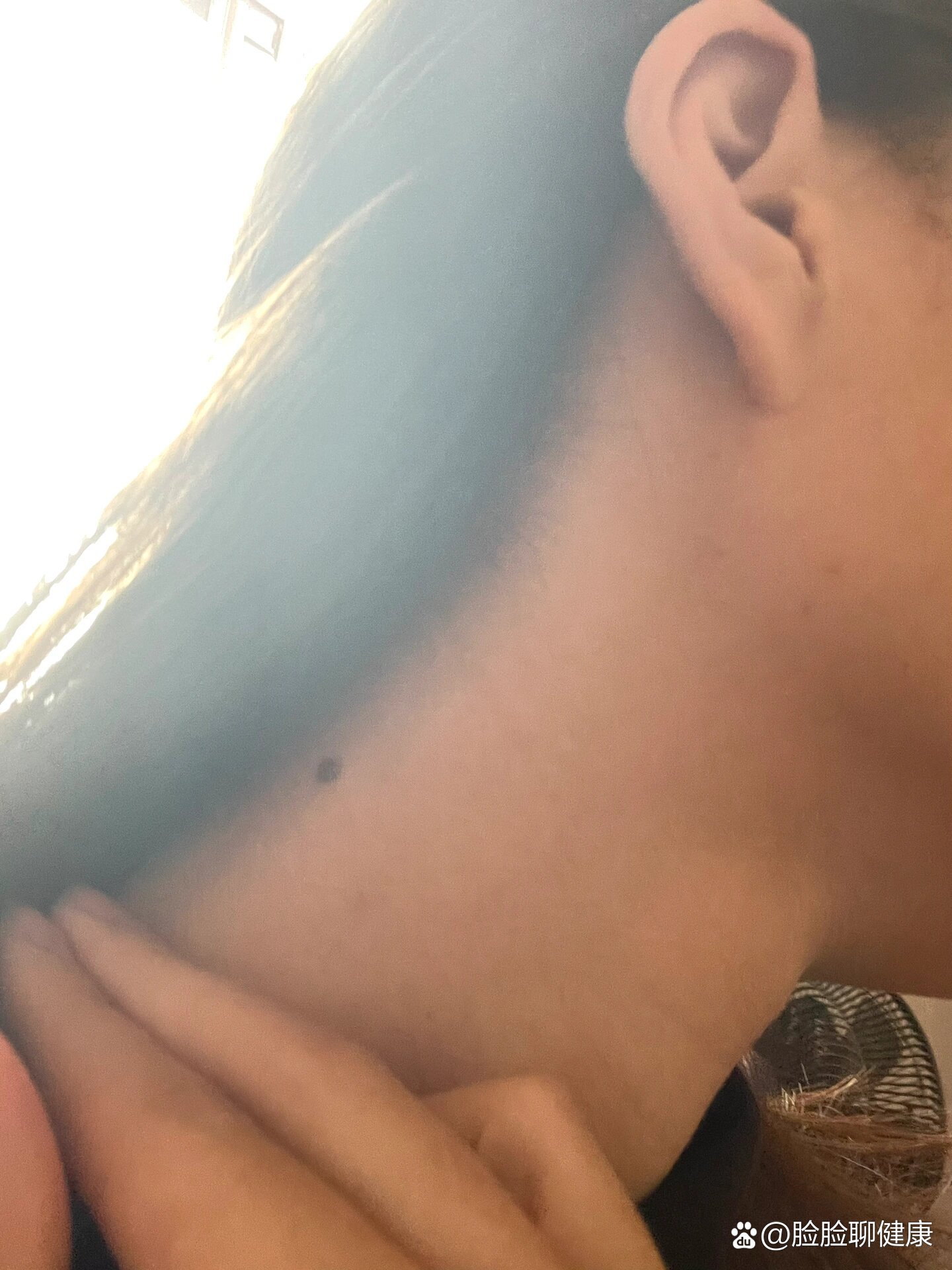 脖子有一颗凸起的黑痣