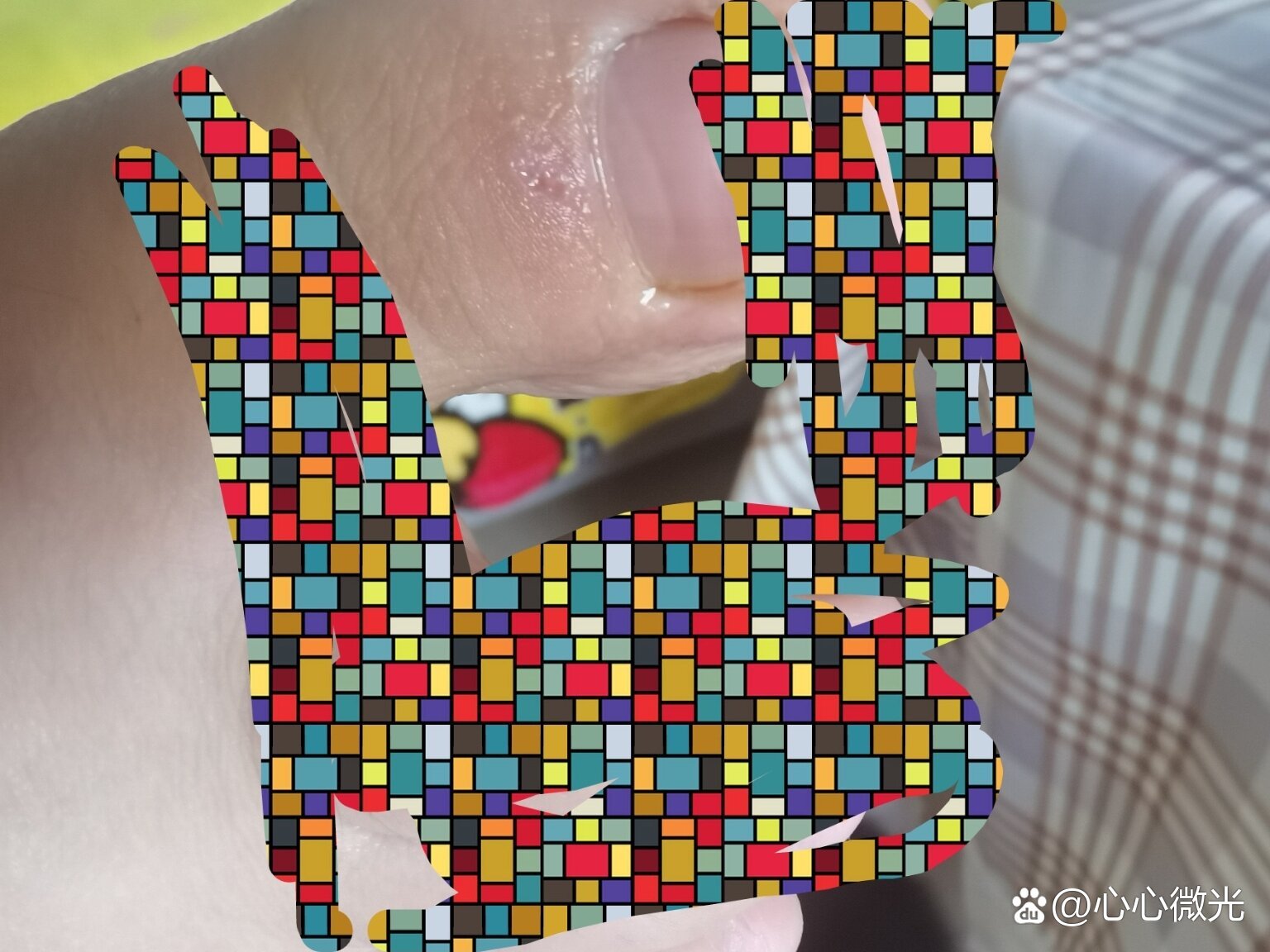 被一个多月的宠物狗舔了一下伤口,需要打疫苗吗