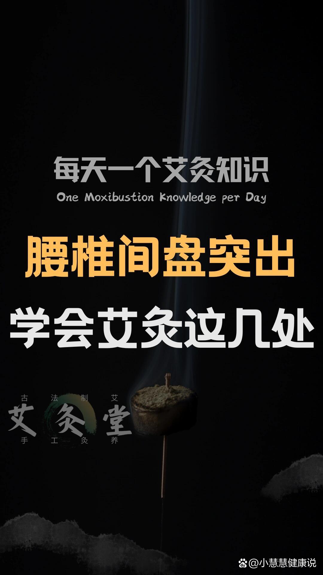 腰椎间盘突出怎么艾灸?