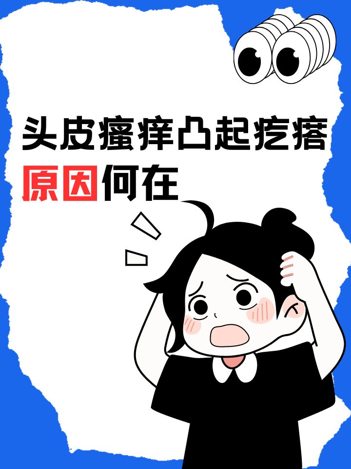 为什么头皮很痒很痒百科在线