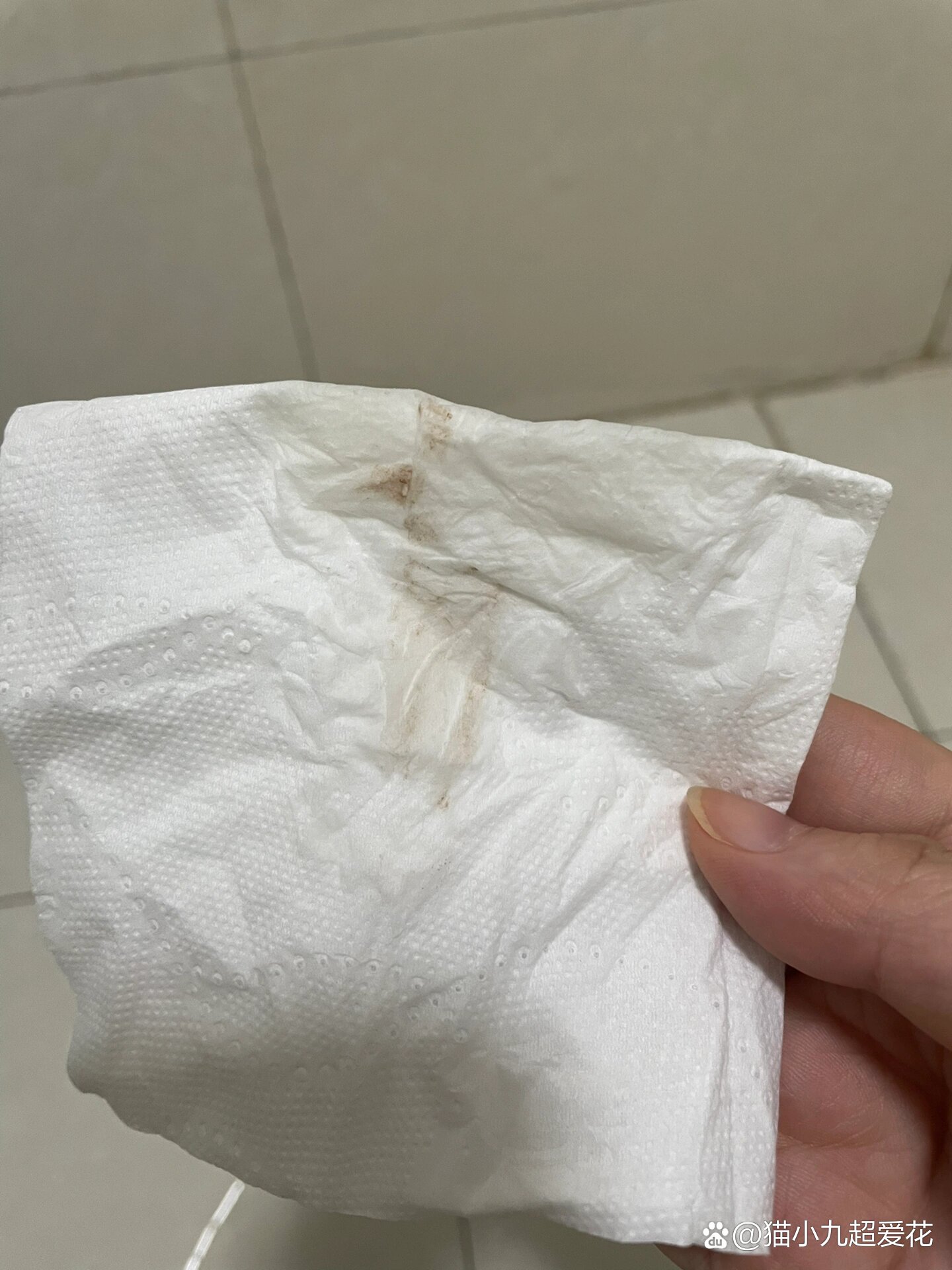 试管移植成功有什么症状(试管婴儿移植成功有什么反应)