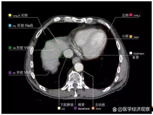 全腹部ct影像高清实用图谱11566
