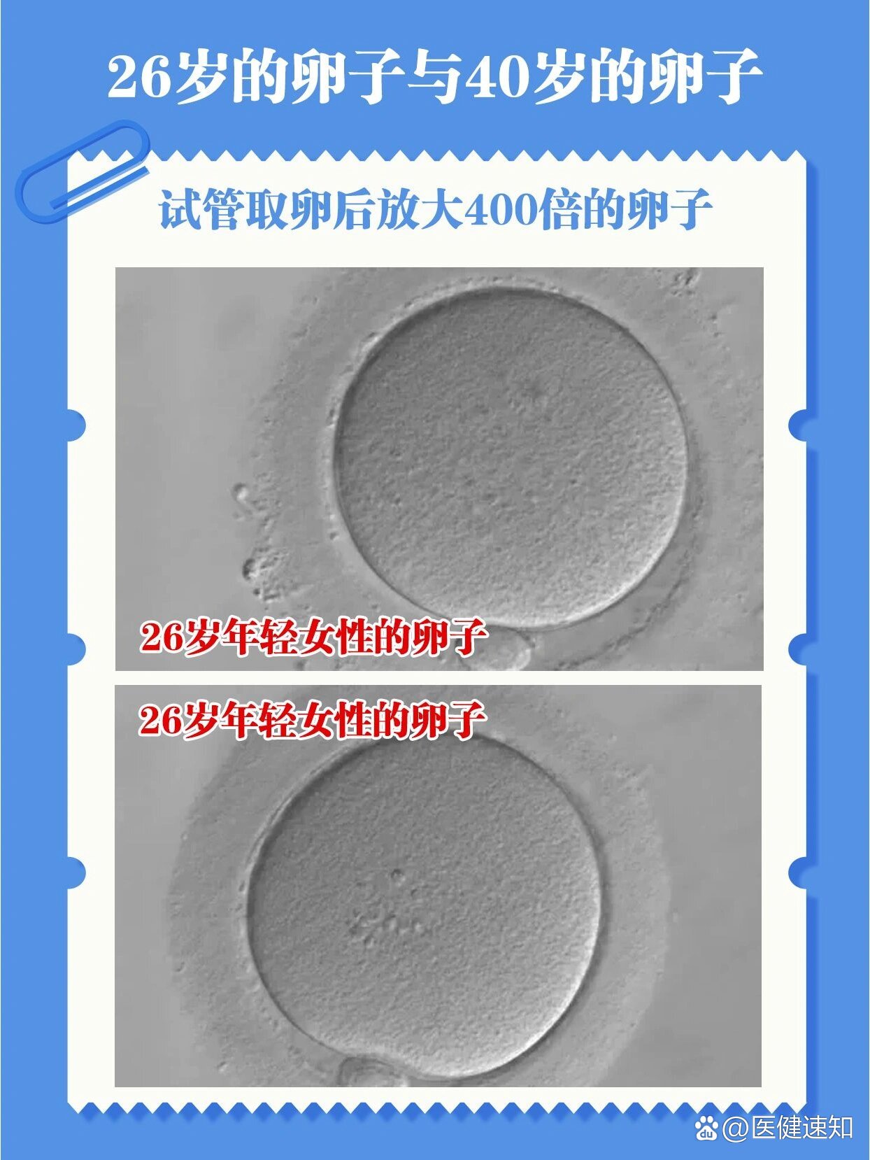 26岁与40岁的卵子差别有多大?