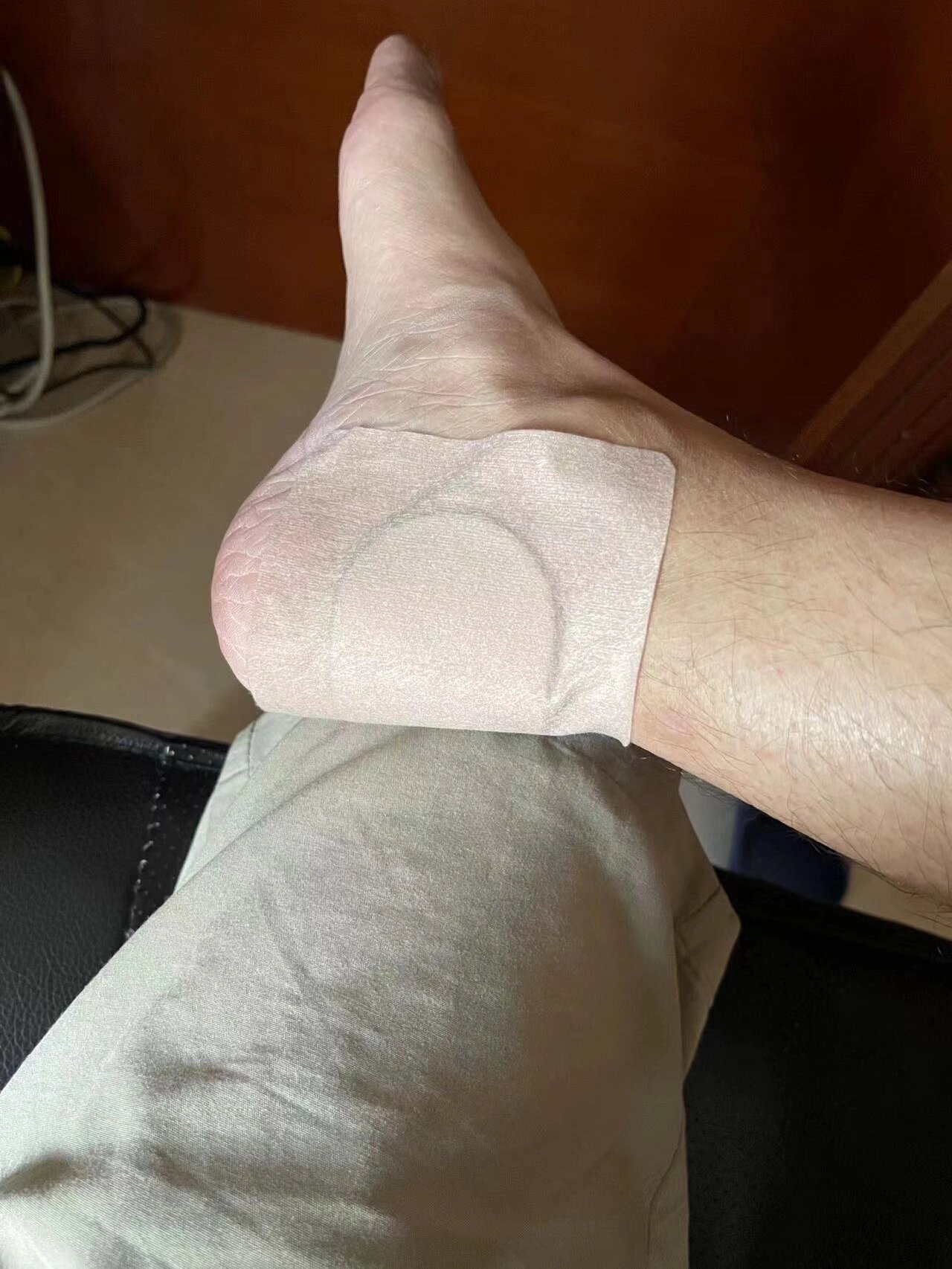 罗浮山风湿膏药滑囊炎一直就有滑囊炎,走多了路或者晚上被子没盖住脚