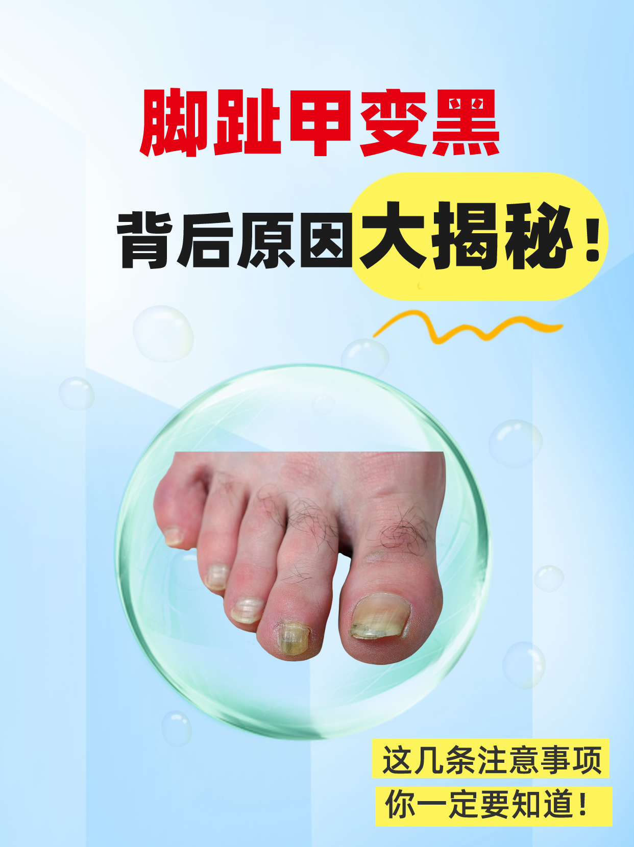 脚趾甲变黑,背后原因大揭秘!