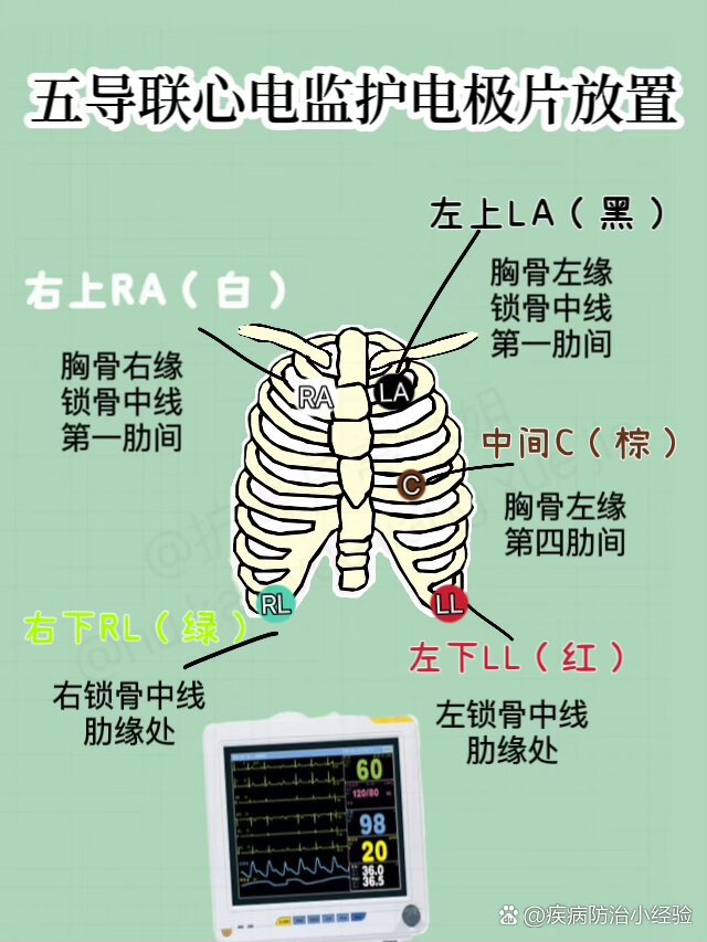 第一钝缘支位置图图片