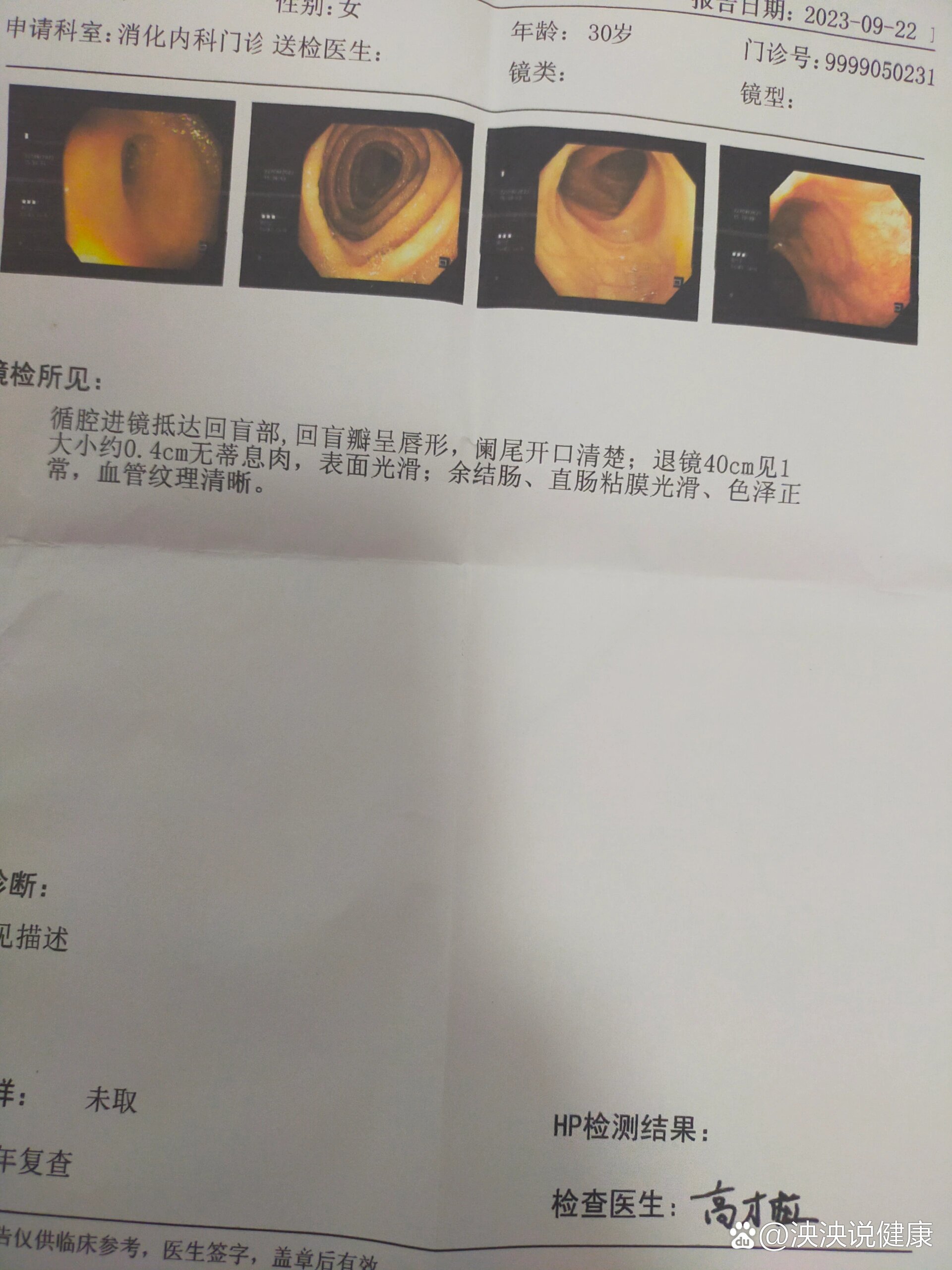 做肠镜感受,生理期犯肠炎感受