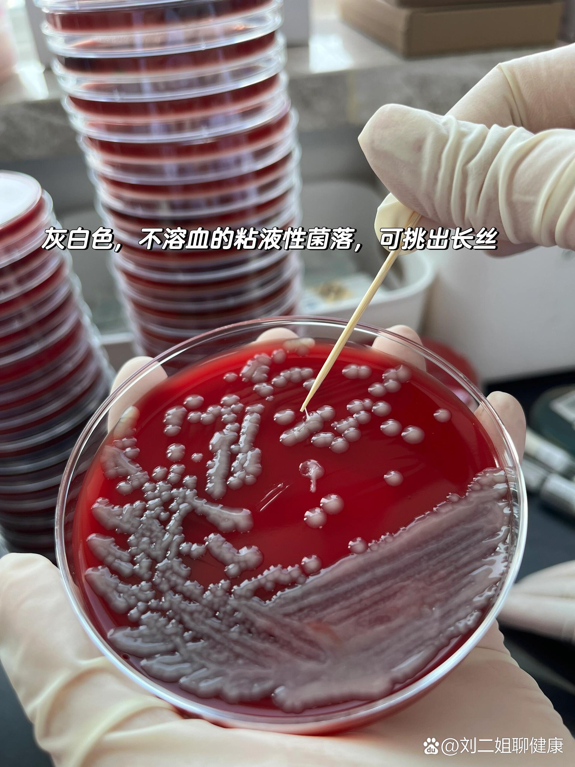  p>肺炎克雷伯菌(阴杆) br>属肠杆菌科,革兰阴性短粗杆菌(阴杆).