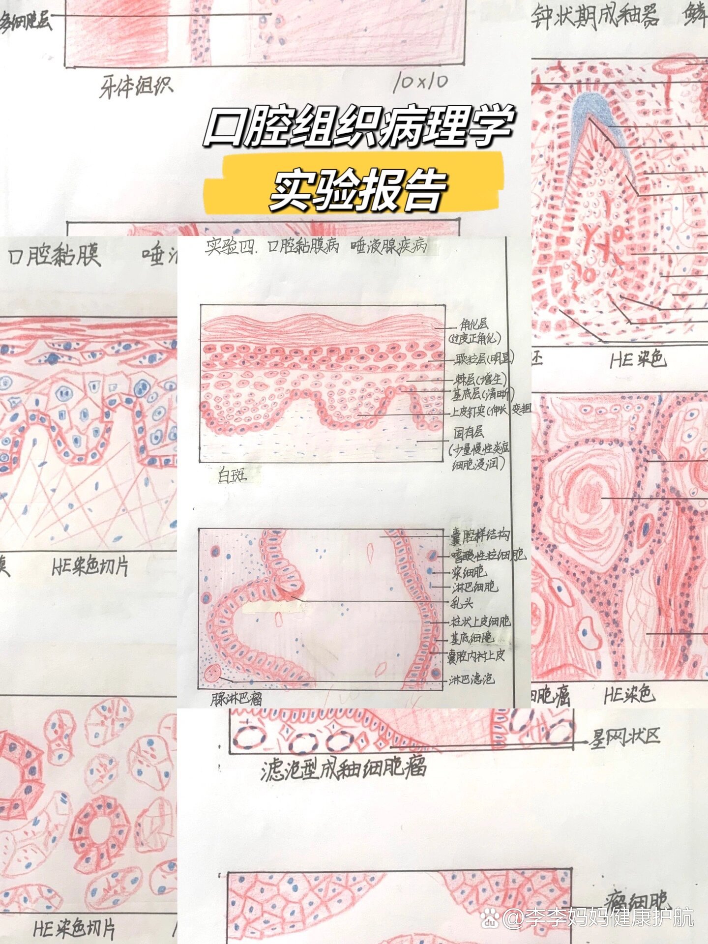 没时间记录每天打卡了,先浅浅更一下口腔组织病理学的红蓝铅笔绘图吧