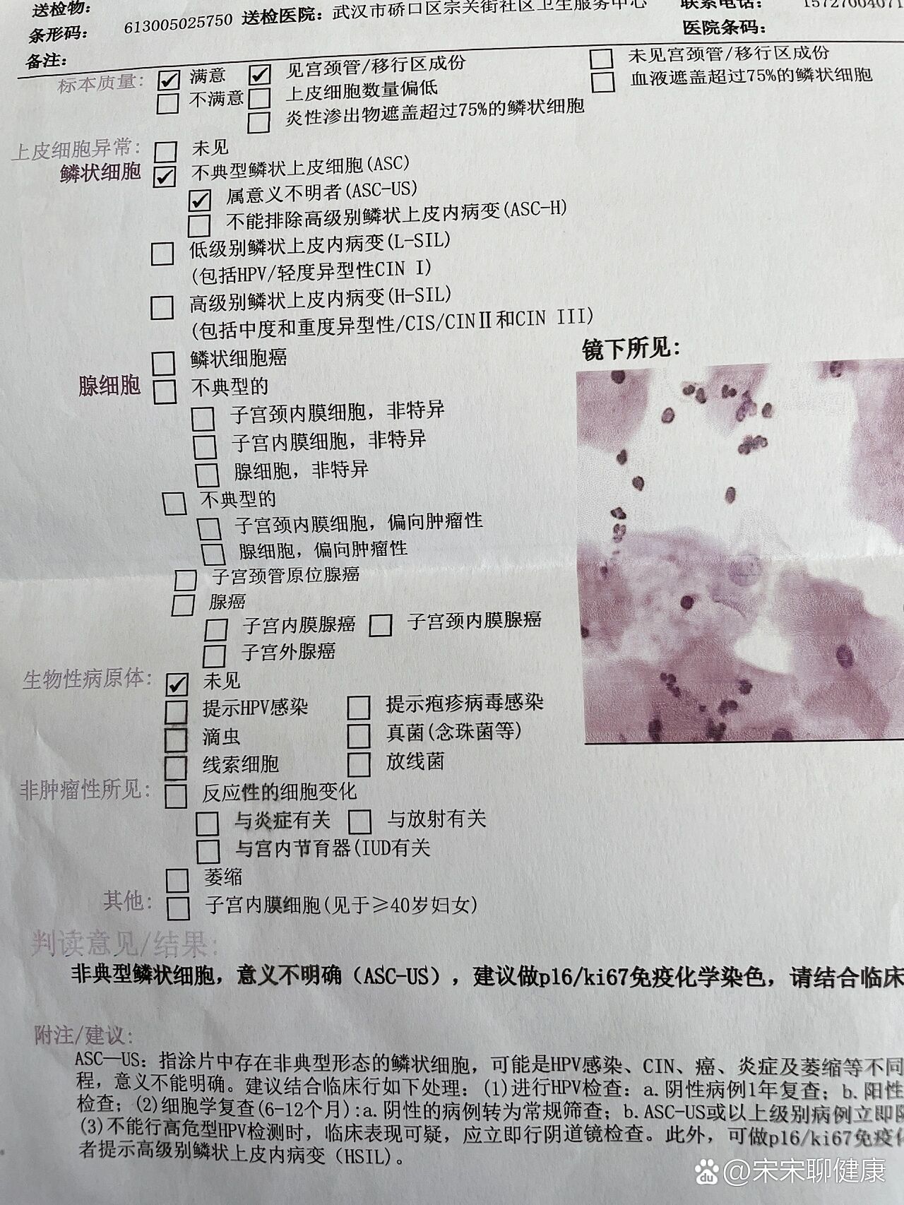hpv宫颈癌筛查16阳性