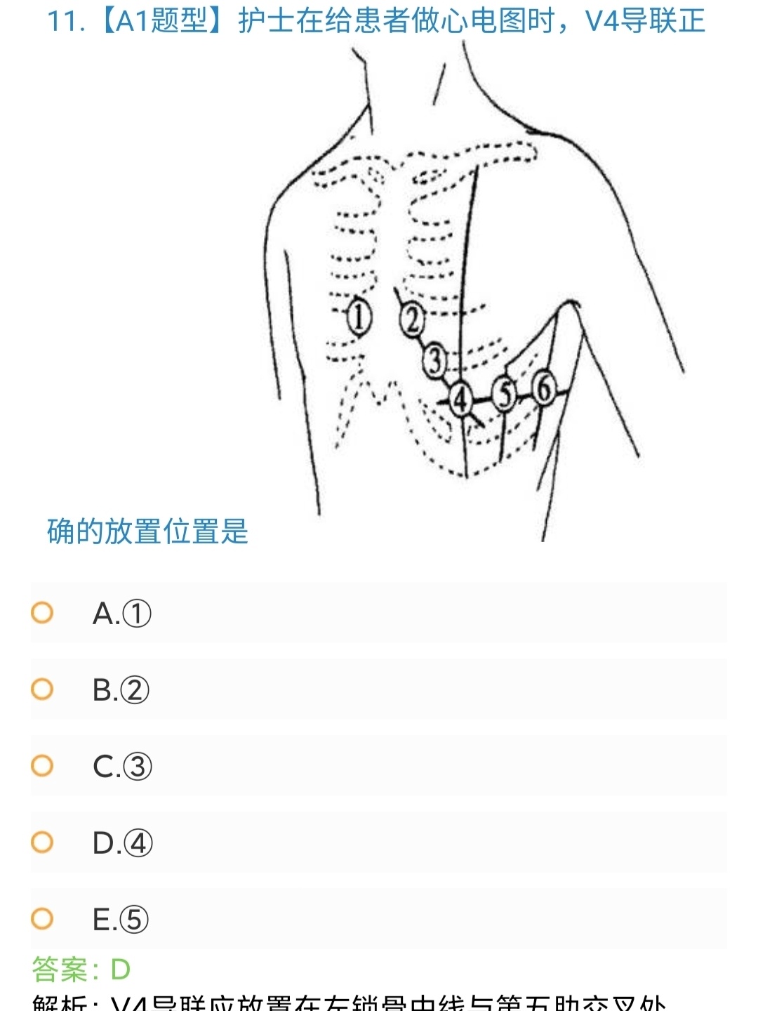 心电图机6导联位置图图片