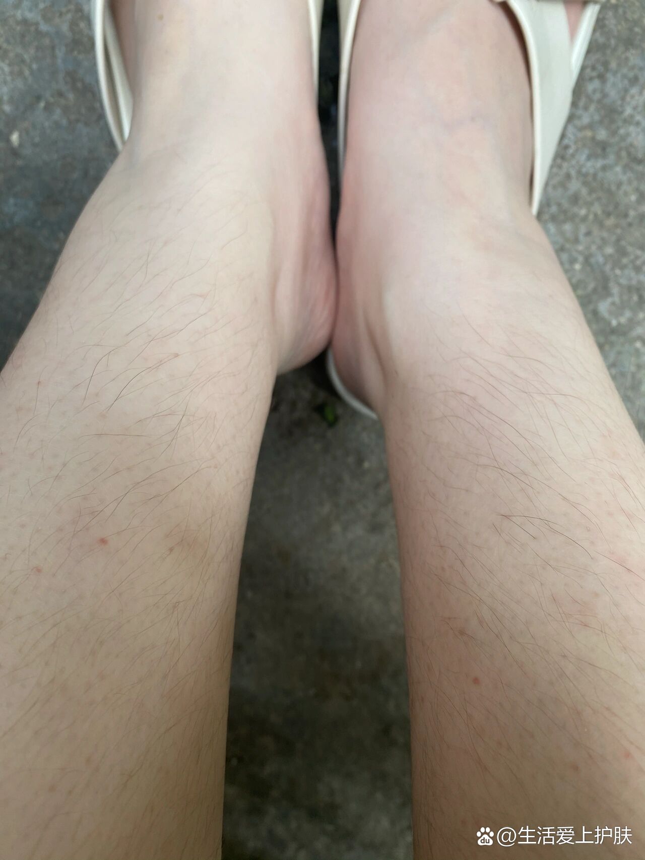 腿毛为什么会突然变得又黑又粗又长050505