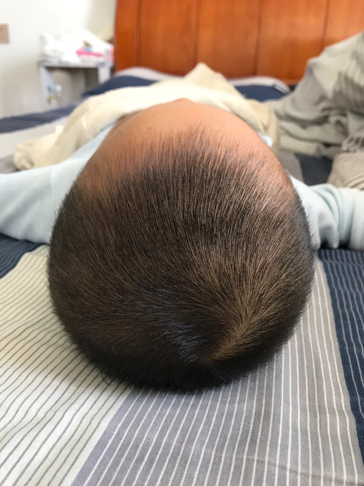 后面几个月他老是喜欢往他的右边睡,稍微有点偏头,后脑勺越