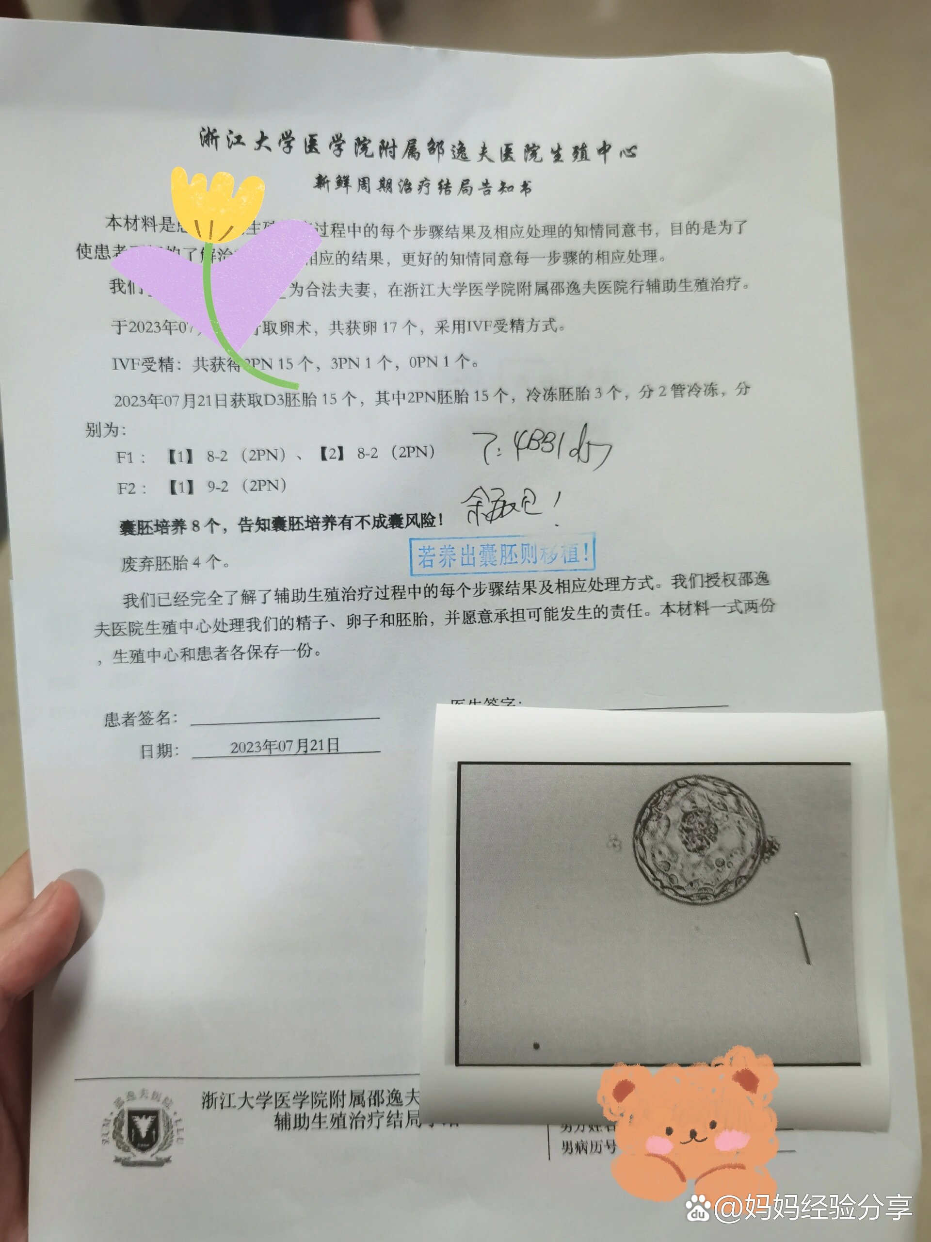 取卵要憋尿吗(取卵需要插尿管吗)