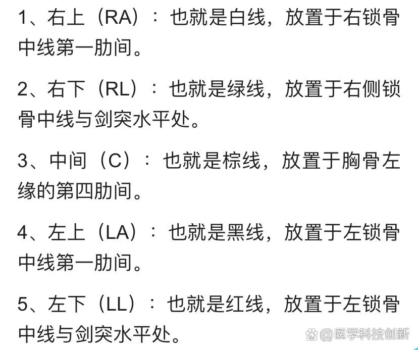 心电监护仪位置图图片