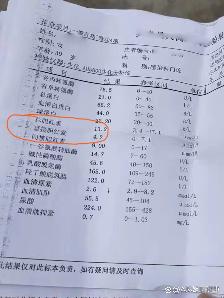 肝功能检查三种胆红素应该怎么看?