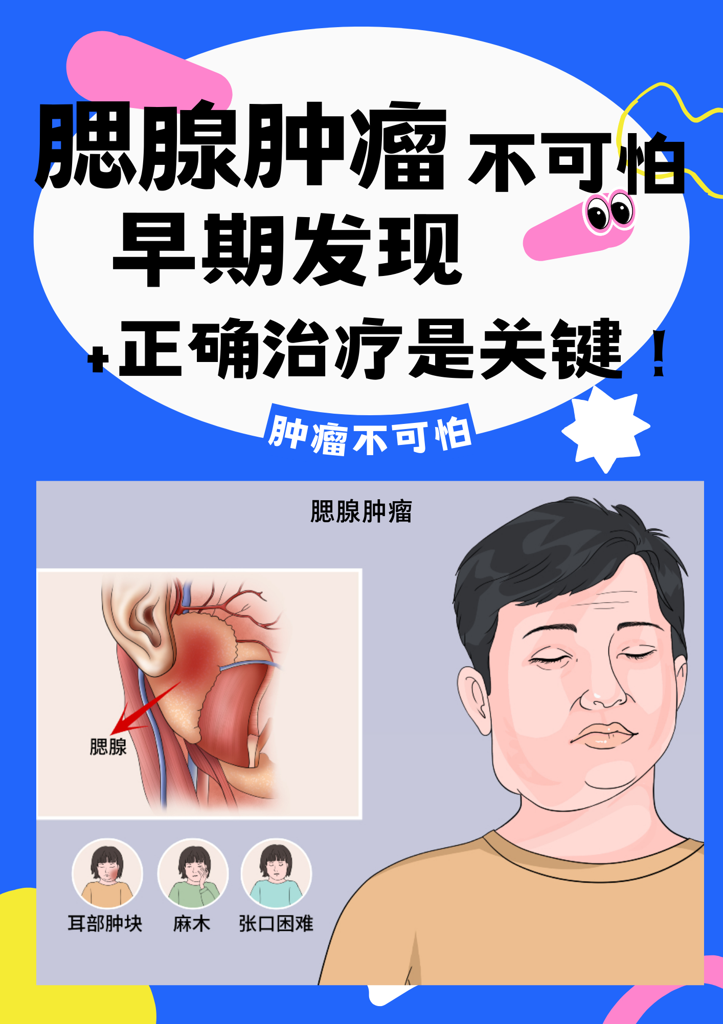 小儿腮腺肿瘤早期图片图片