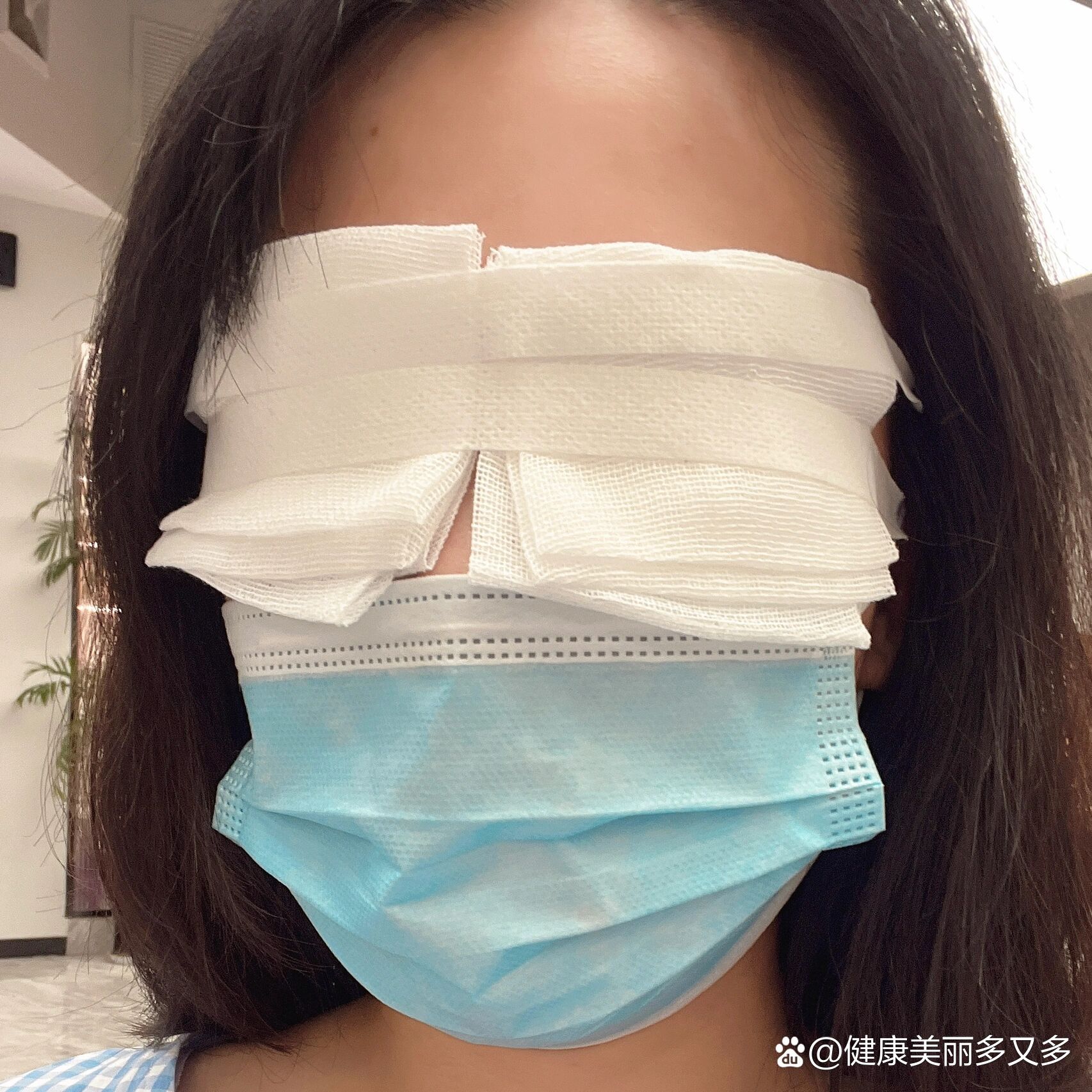 纱布挡了一下事实证明非常有用因为揭开时候第一层上面潮潮的