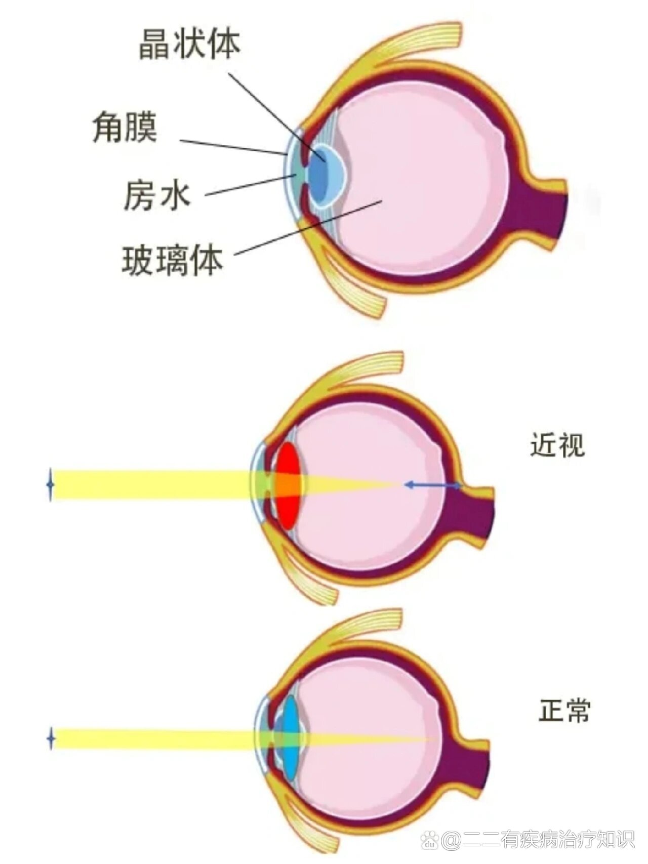 晶状体图解图片