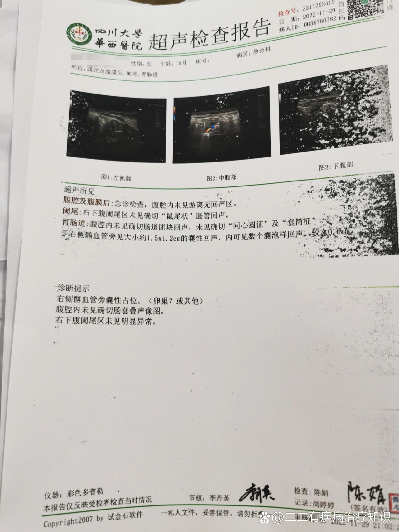 早期肠套叠,医生教正确解套手法