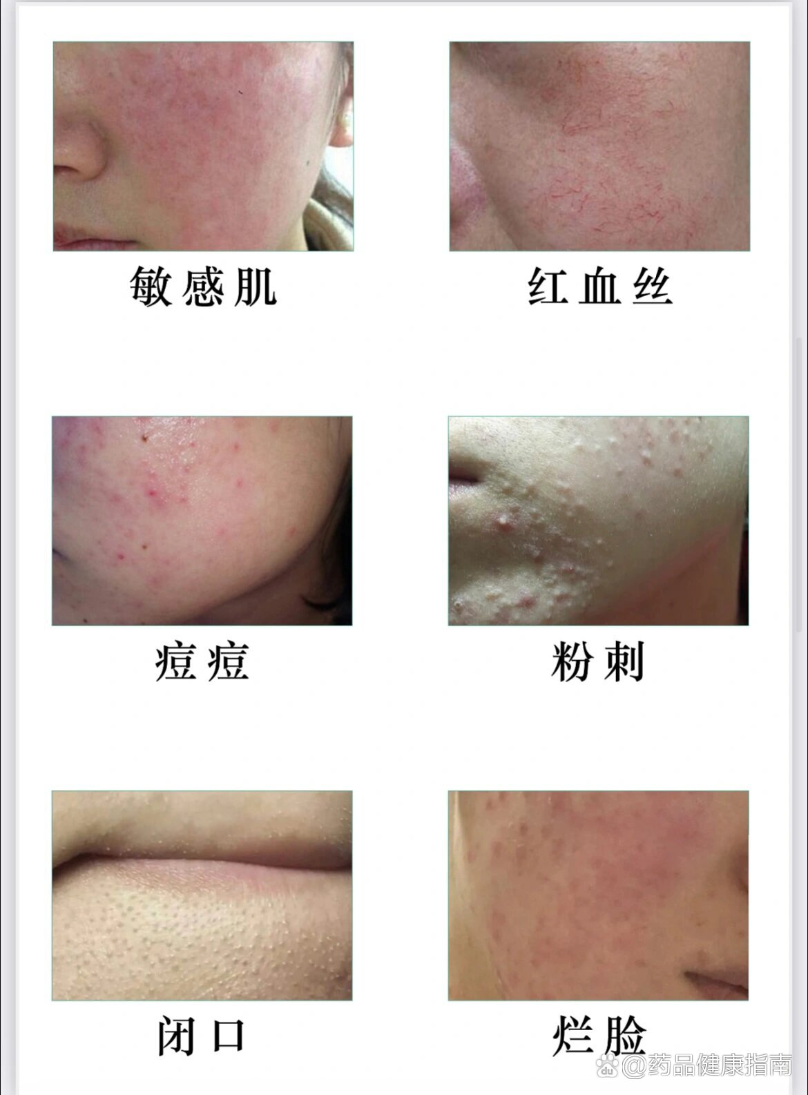激素脸恢复过程需要多长时间?