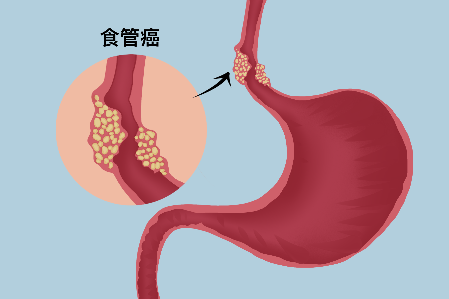 食管有多长图片