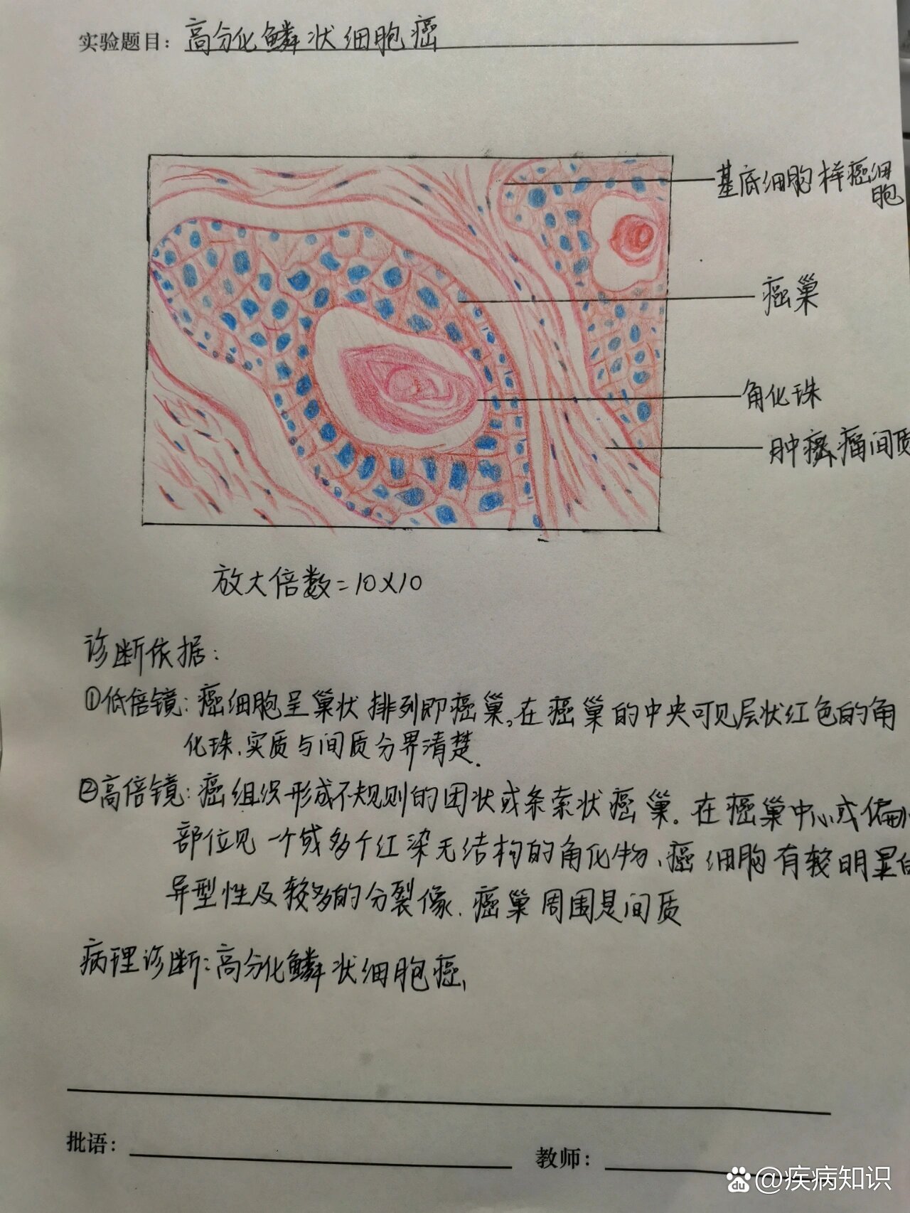 绒毛膜癌红蓝铅笔绘图图片