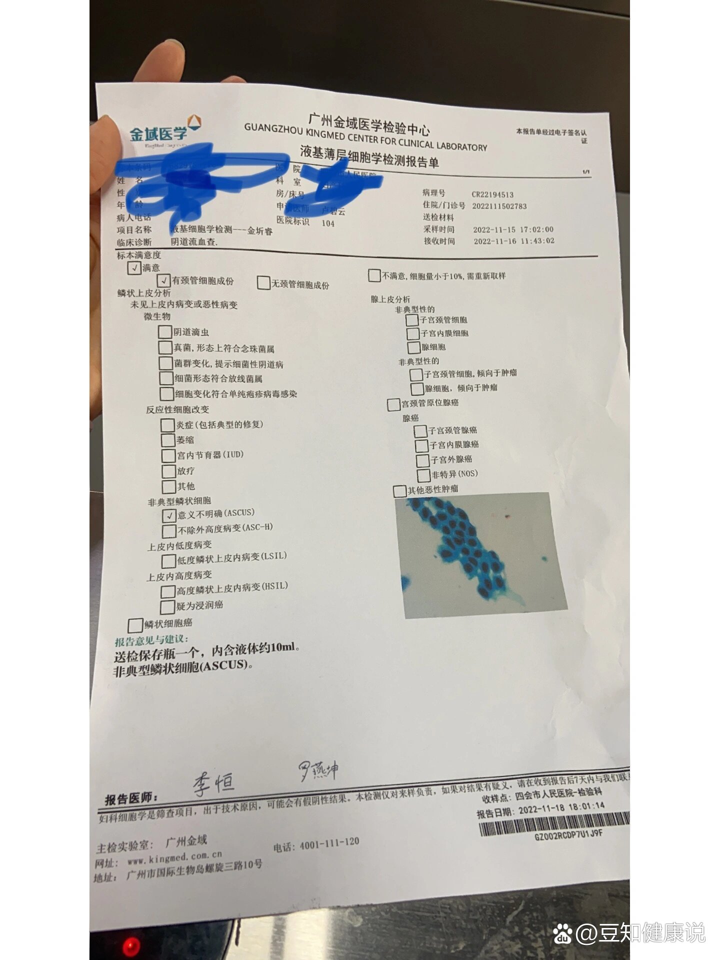 液基薄层细胞检查异常