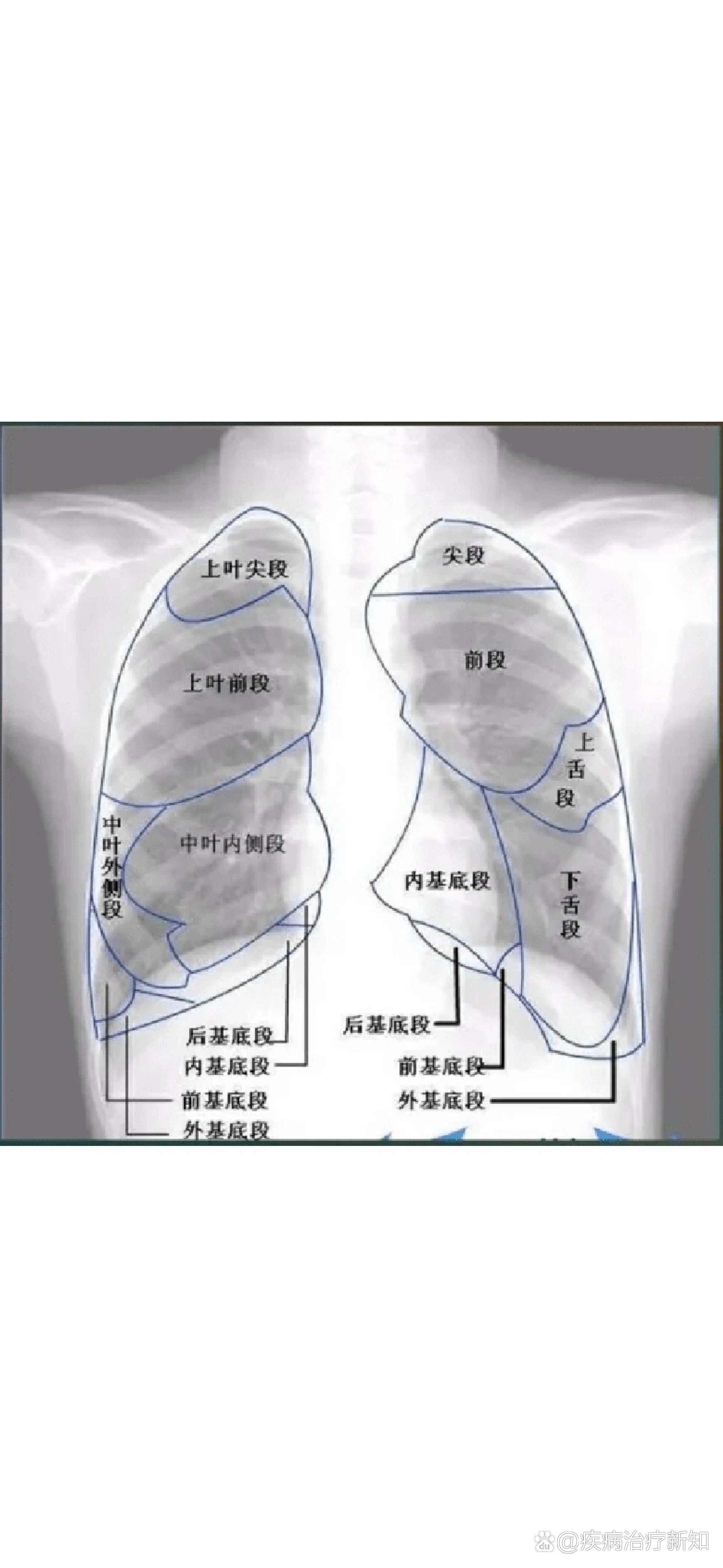 解剖图肺图片