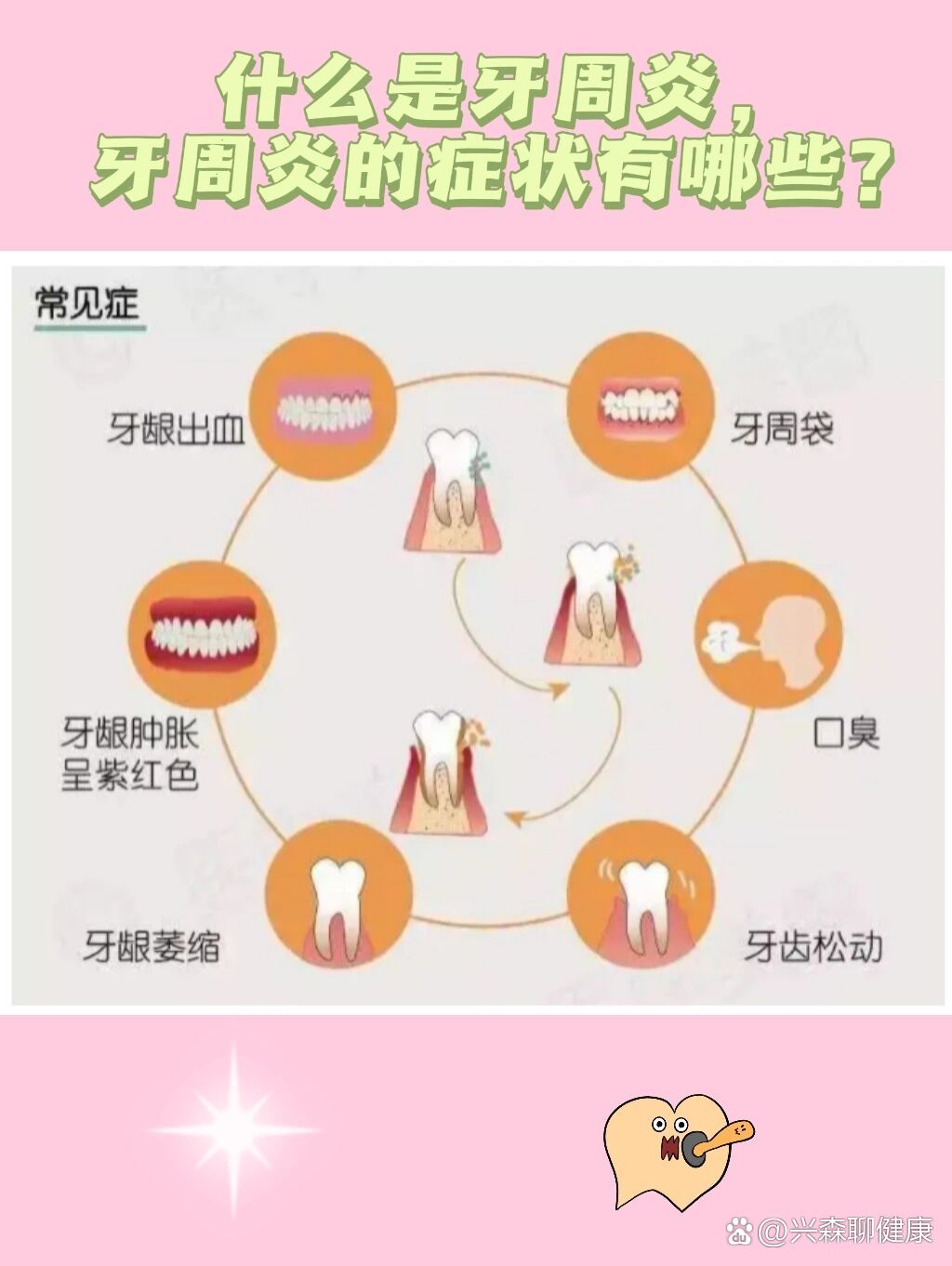 牙周炎的症状有哪些?