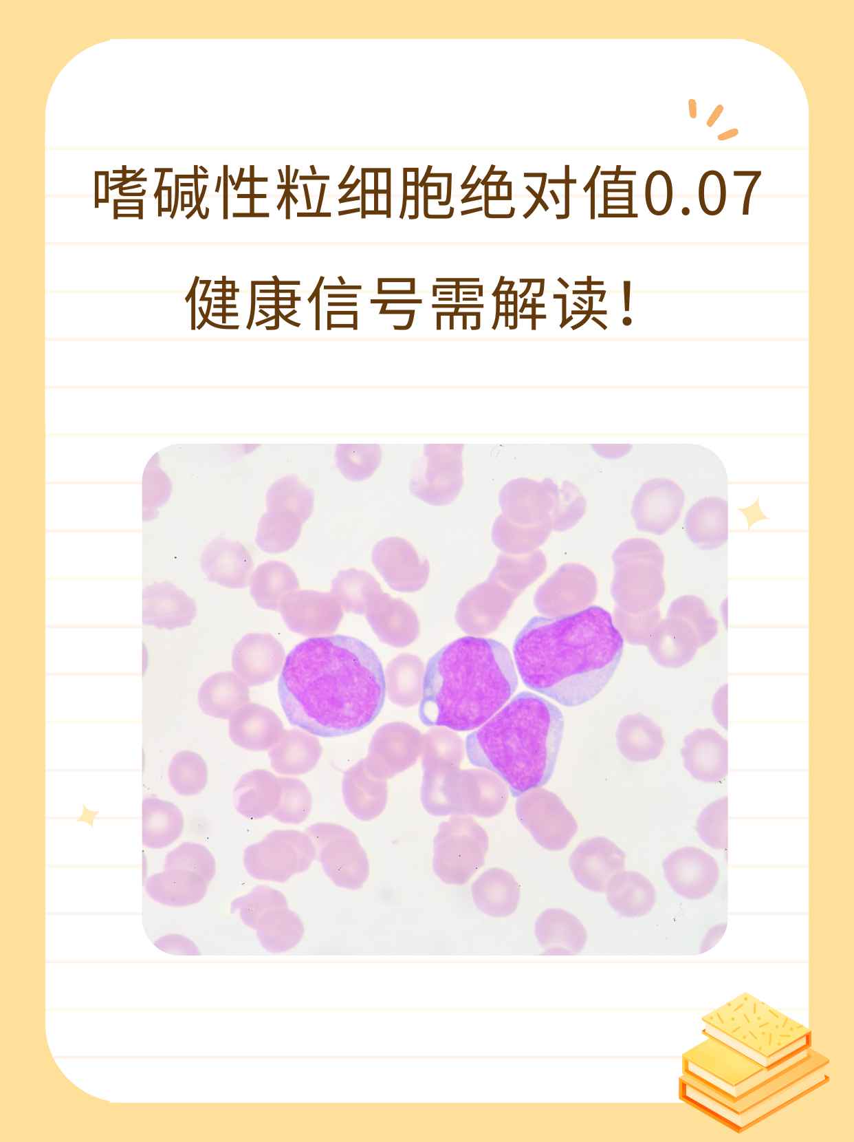 嗜碱性粒细胞绝对值0.07:健康信号需解读!