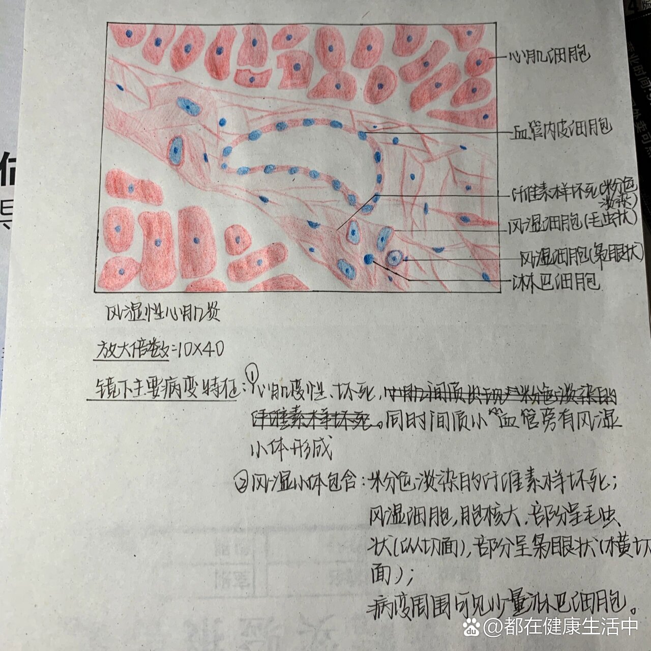 伤寒红蓝铅笔图图片