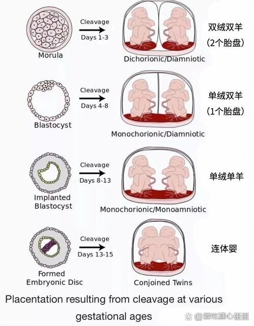 异卵双胞胎怀孕卡通图片