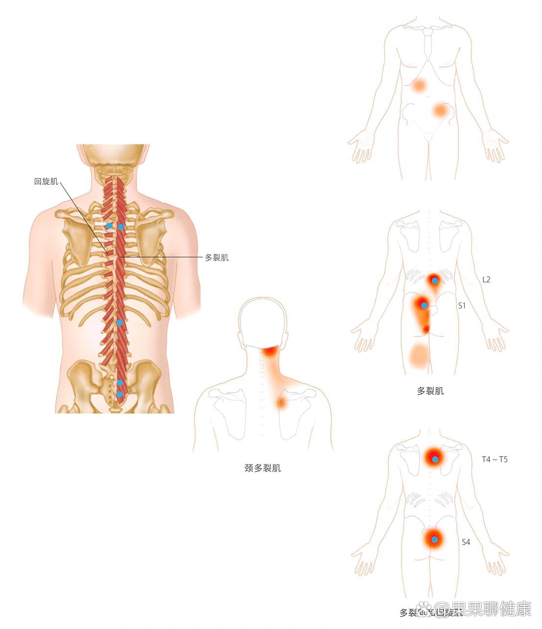 横纹肌分布图片